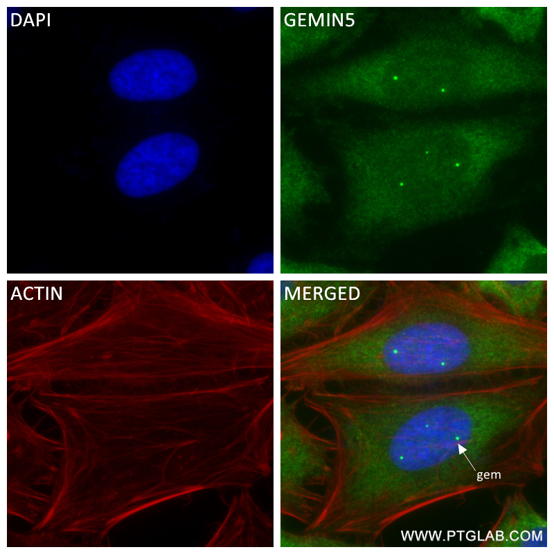 Immunofluorescence (IF) / fluorescent staining of HeLa cells using GEMIN5 Recombinant antibody (84171-3-RR)