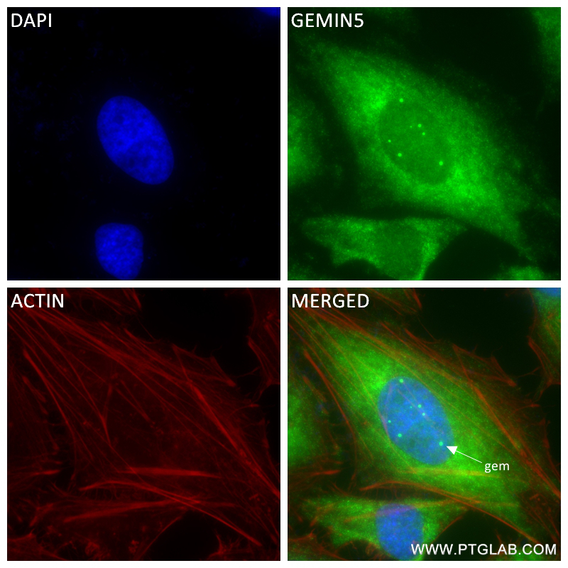 Immunofluorescence (IF) / fluorescent staining of HeLa cells using GEMIN5 Recombinant antibody (84171-5-RR)