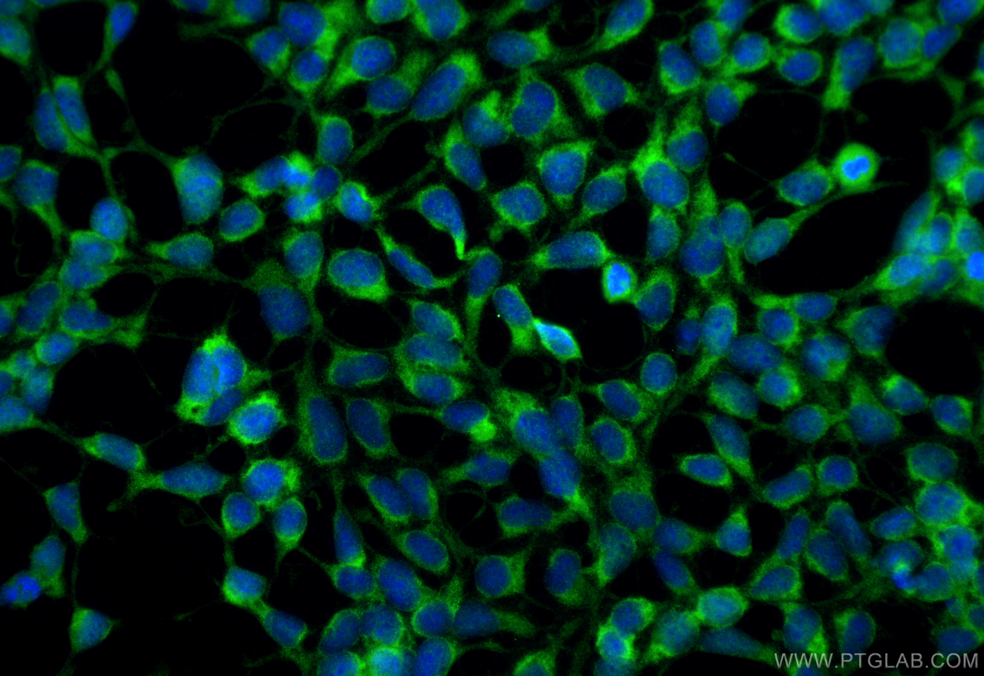 Immunofluorescence (IF) / fluorescent staining of HEK-293 cells using GEMIN6 Polyclonal antibody (12307-2-AP)