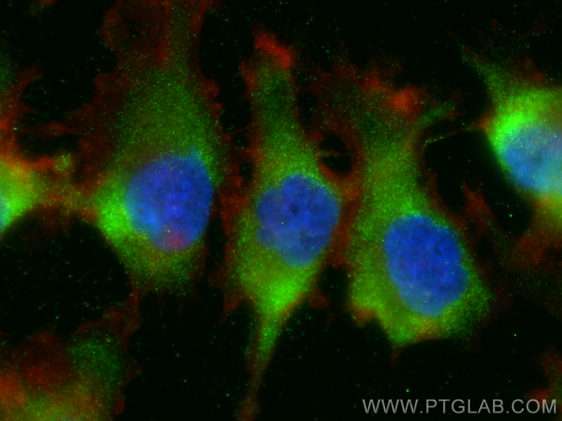 Immunofluorescence (IF) / fluorescent staining of A172 cells using GFAP Polyclonal antibody (16825-1-AP)