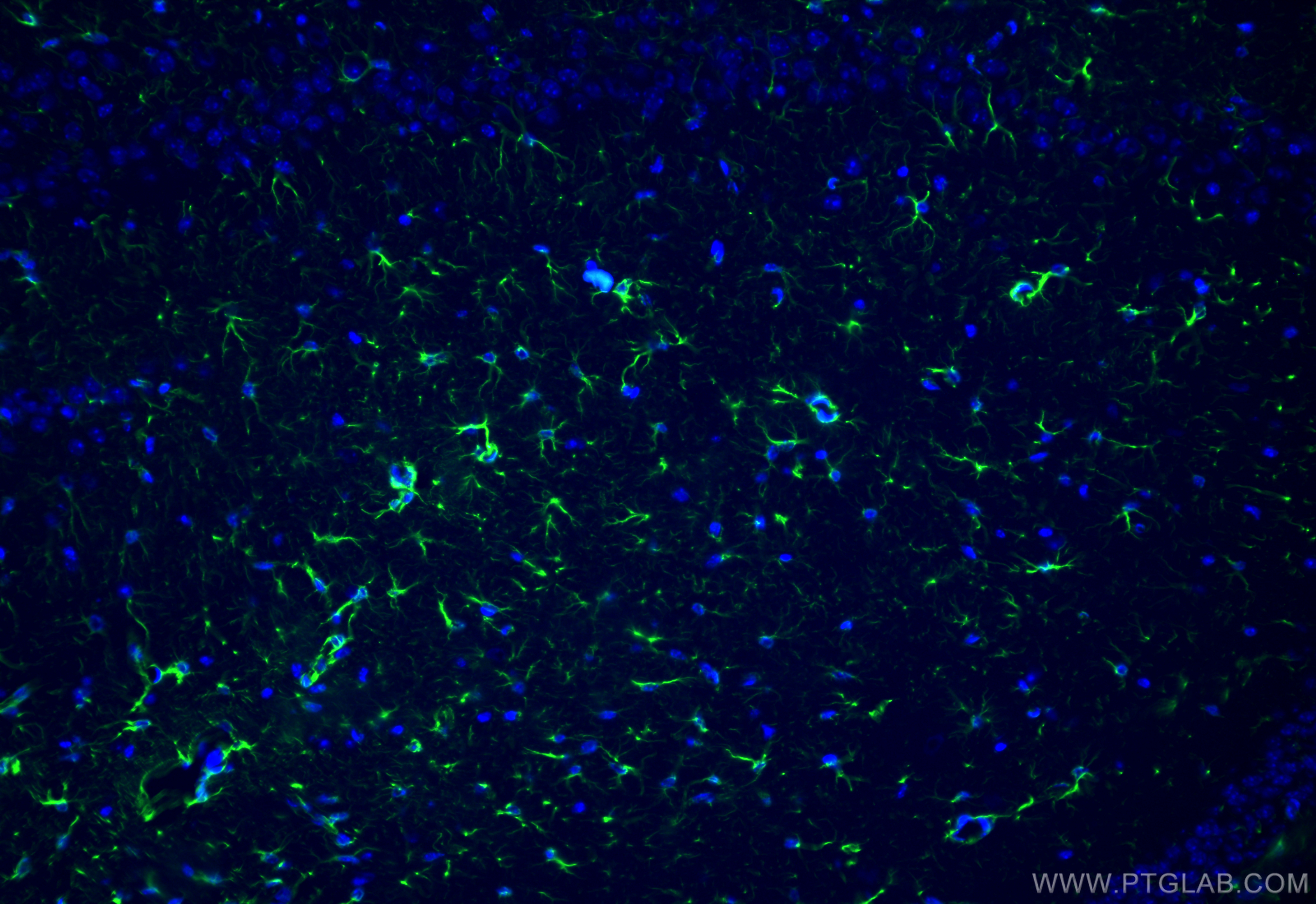 Immunofluorescence (IF) / fluorescent staining of mouse brain tissue using GFAP Polyclonal antibody (23935-1-AP)