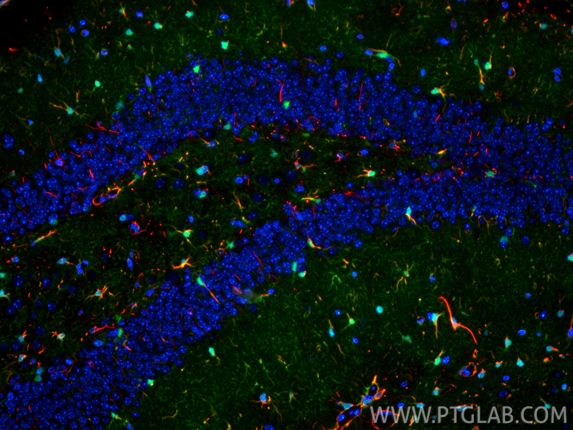 Immunofluorescence (IF) / fluorescent staining of mouse brain tissue using GFAP Monoclonal antibody (60190-1-Ig)
