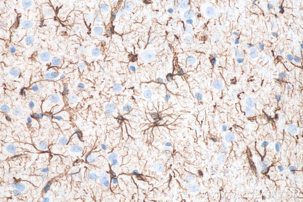 Immunohistochemistry (IHC) staining of rat brain tissue using GFAP Monoclonal antibody (60190-1-Ig)