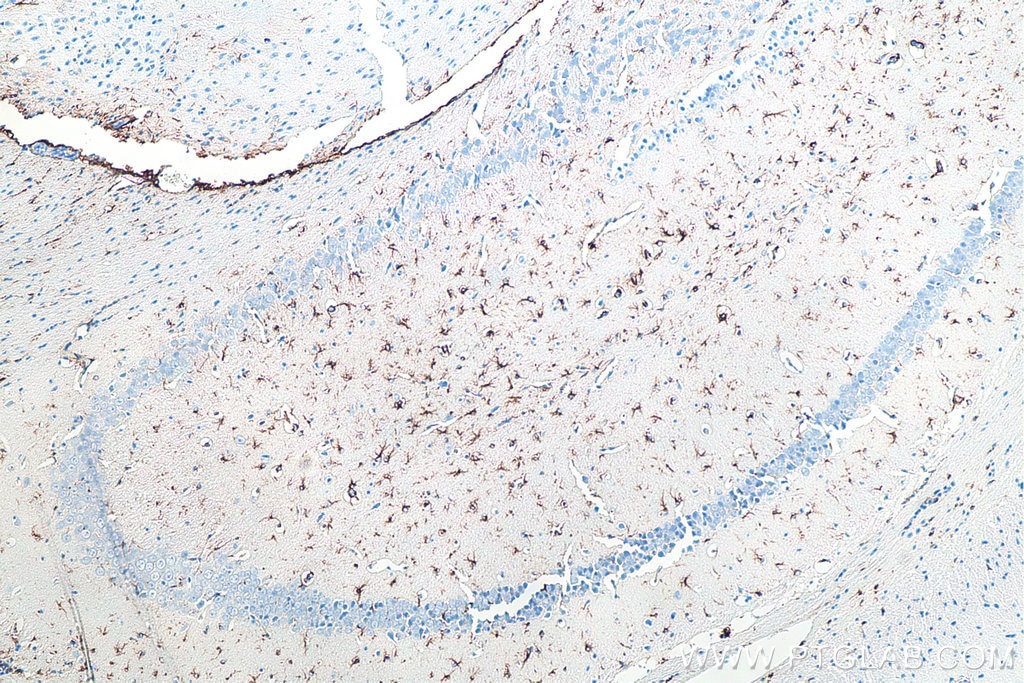 Immunohistochemistry (IHC) staining of mouse brain tissue using GFAP Monoclonal antibody (60190-1-Ig)