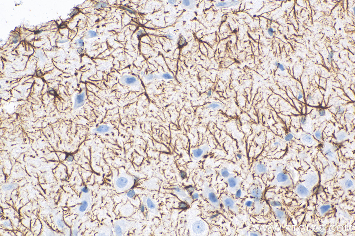 Immunohistochemistry (IHC) staining of rat brain tissue using GFAP Monoclonal antibody (60190-1-Ig)