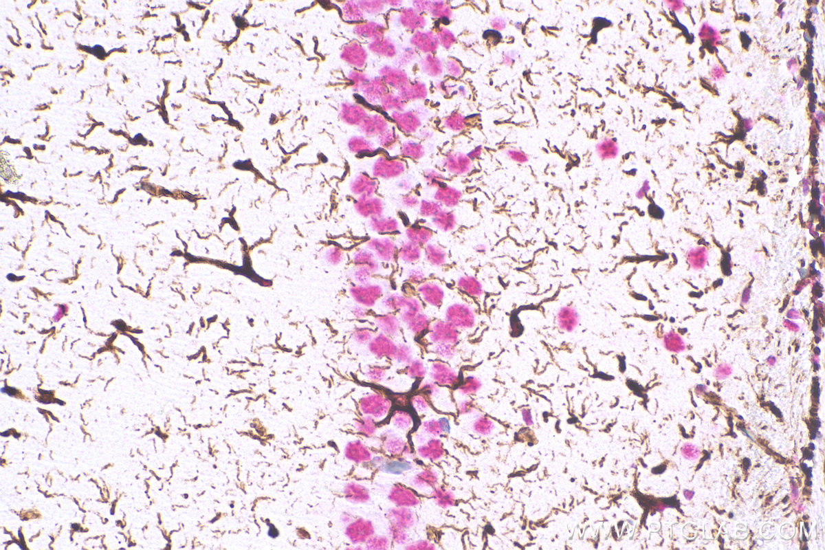 Immunohistochemistry (IHC) staining of mouse brain tissue using GFAP Monoclonal antibody (60190-1-Ig)