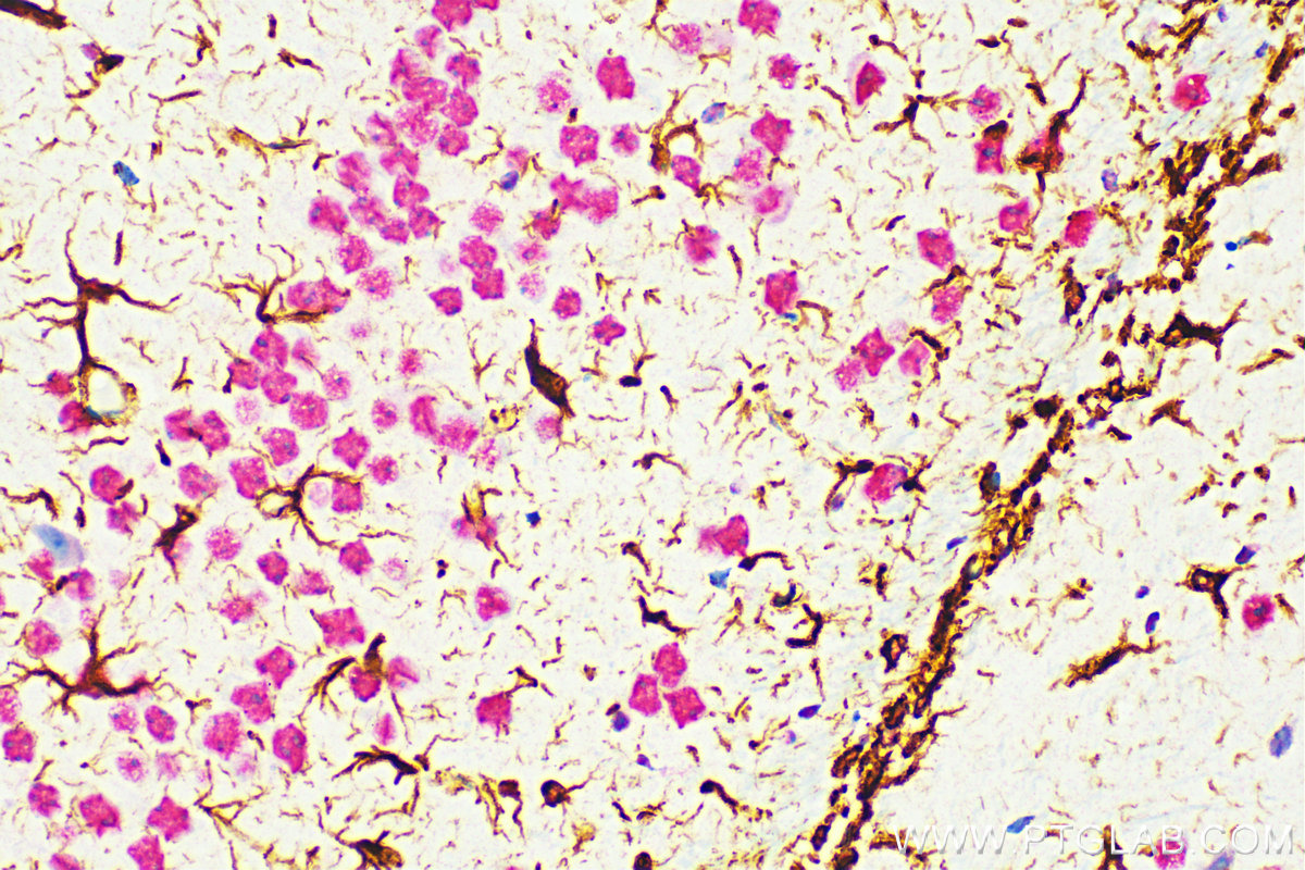 Immunohistochemistry (IHC) staining of mouse brain tissue using GFAP Monoclonal antibody (60190-1-Ig)