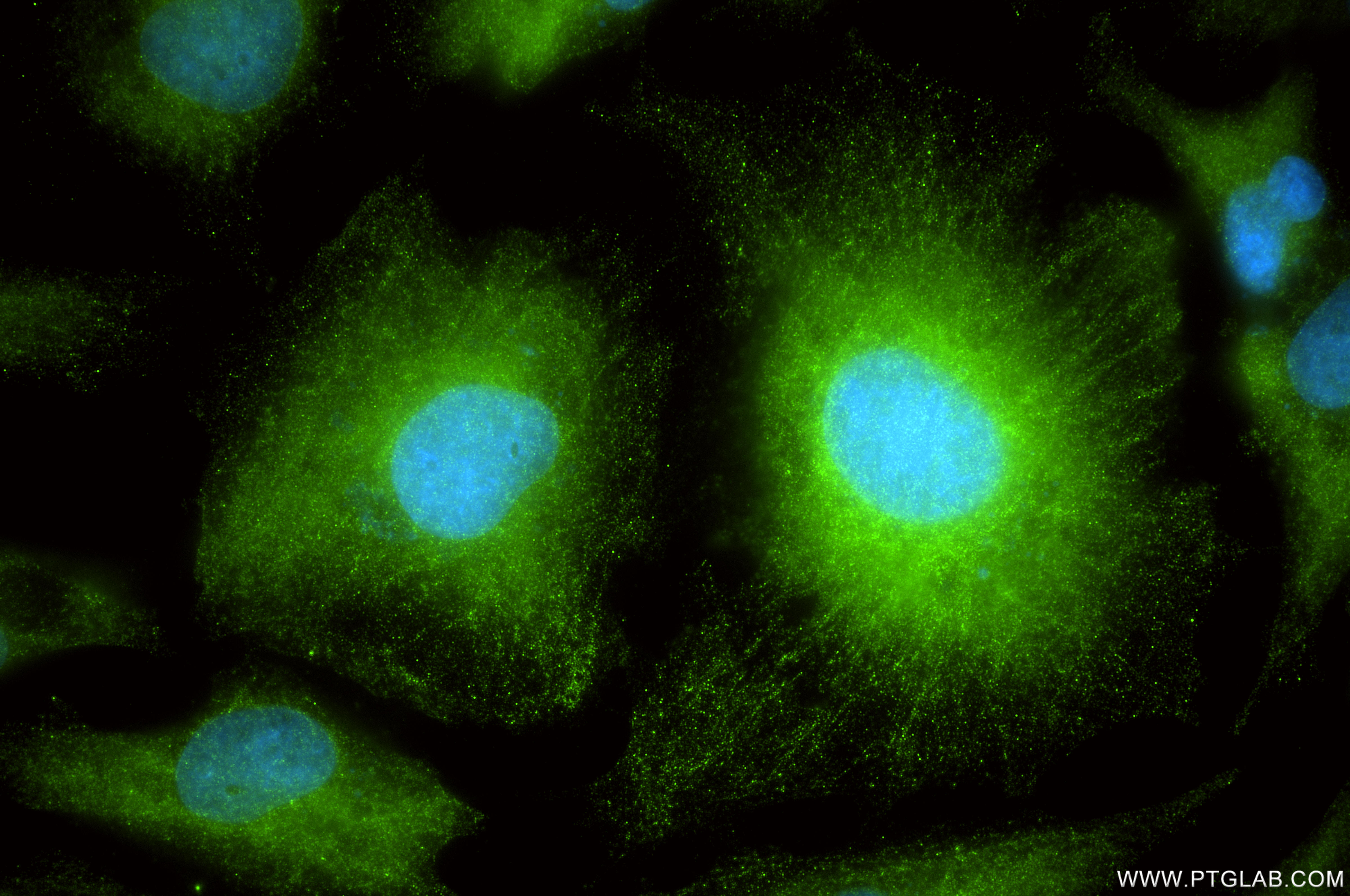 Immunofluorescence (IF) / fluorescent staining of U-251 cells using GFAP Recombinant monoclonal antibody (81063-1-RR)