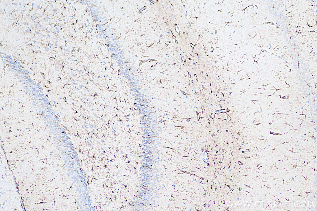Immunohistochemistry (IHC) staining of rat brain tissue using Biotin-conjugated GFAP Monoclonal antibody (Biotin-60190)