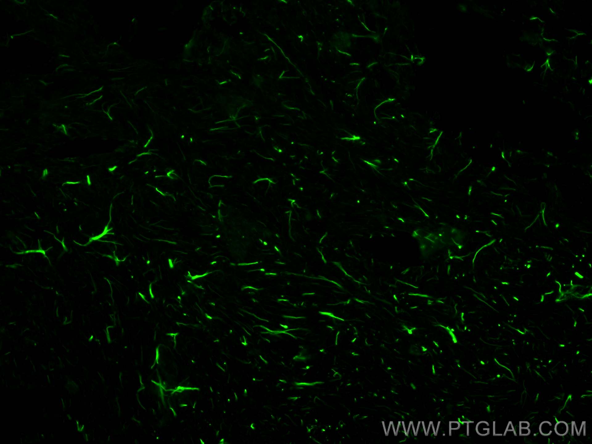 Immunofluorescence (IF) / fluorescent staining of mouse brain tissue using CoraLite® Plus 488-conjugated GFAP Recombinant ant (CL488-81063)