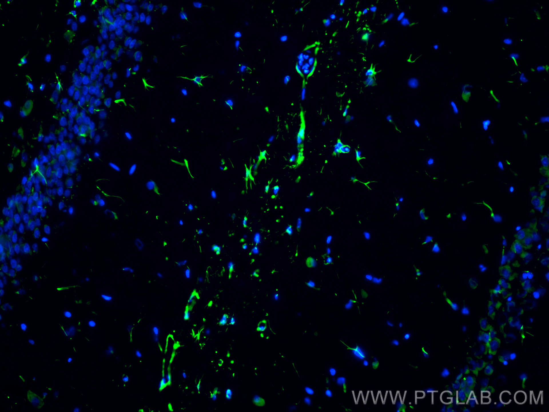 Immunofluorescence (IF) / fluorescent staining of rat brain tissue using CoraLite® Plus 488-conjugated GFAP Recombinant ant (CL488-81063)