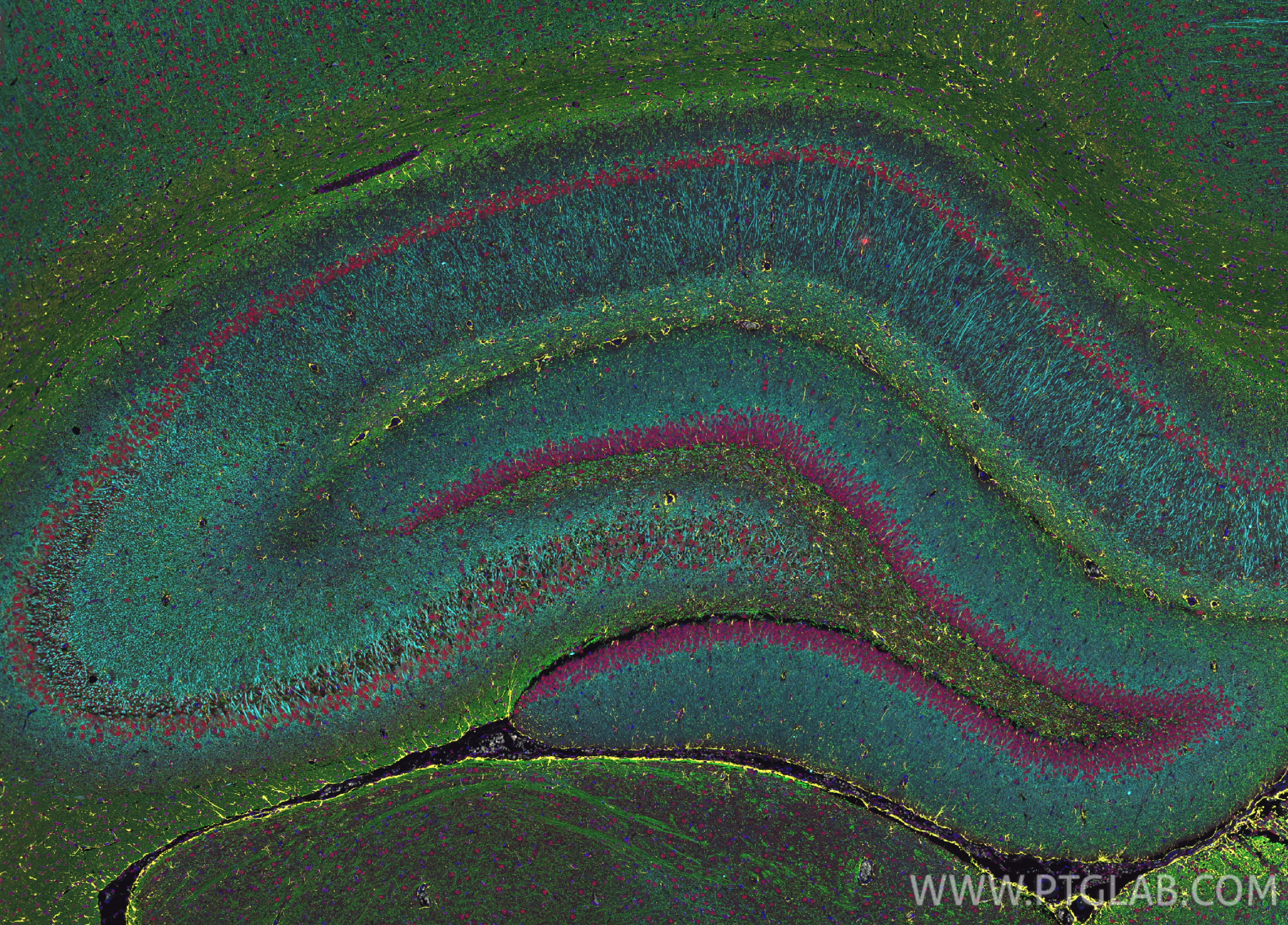 Immunofluorescence (IF) / fluorescent staining of rat brain tissue using CoraLite®532-conjugated GFAP Recombinant antibody (CL532-81063)