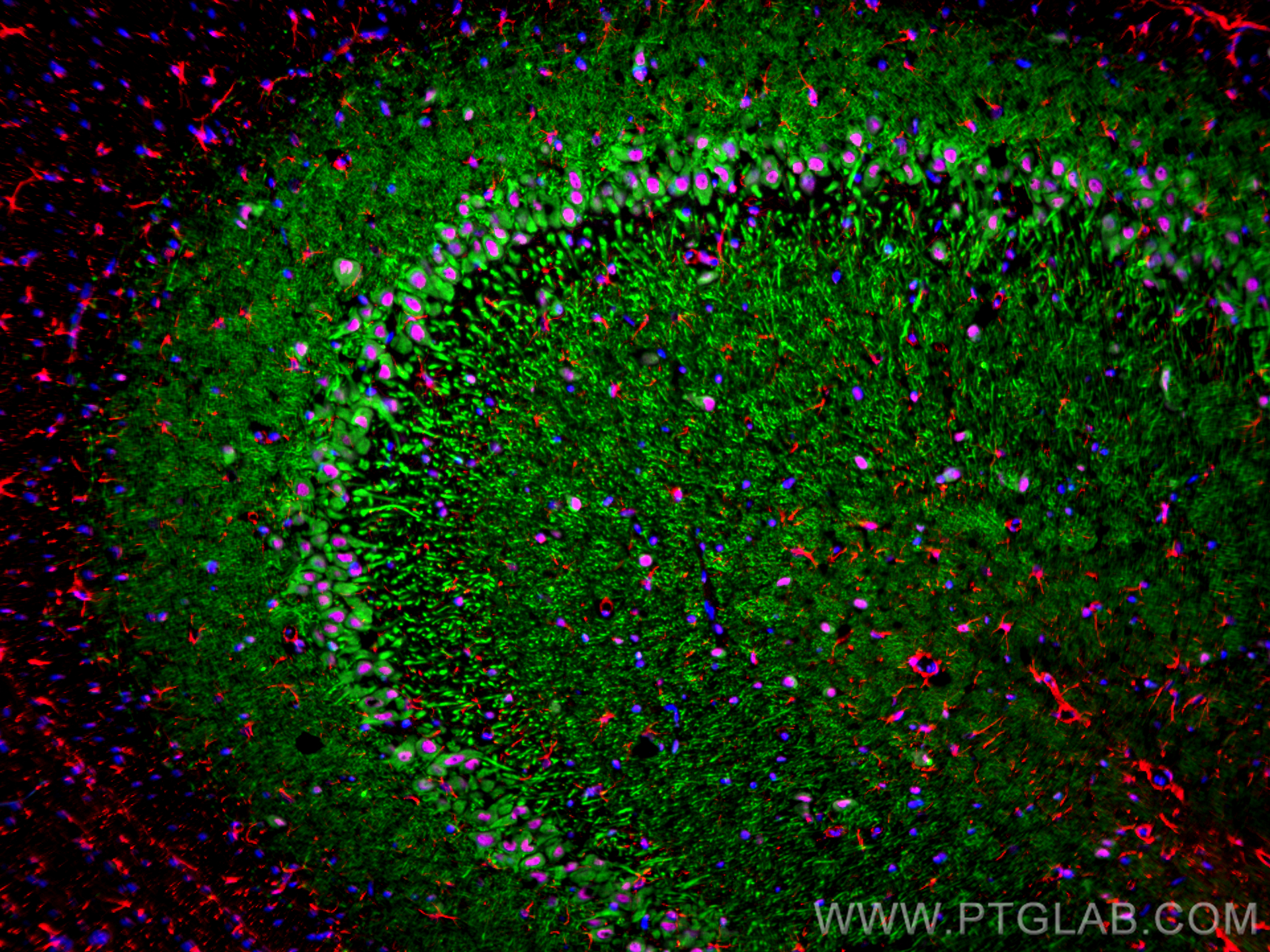 Immunofluorescence (IF) / fluorescent staining of rat brain tissue using CoraLite®594-conjugated GFAP Polyclonal antibody (CL594-16825)