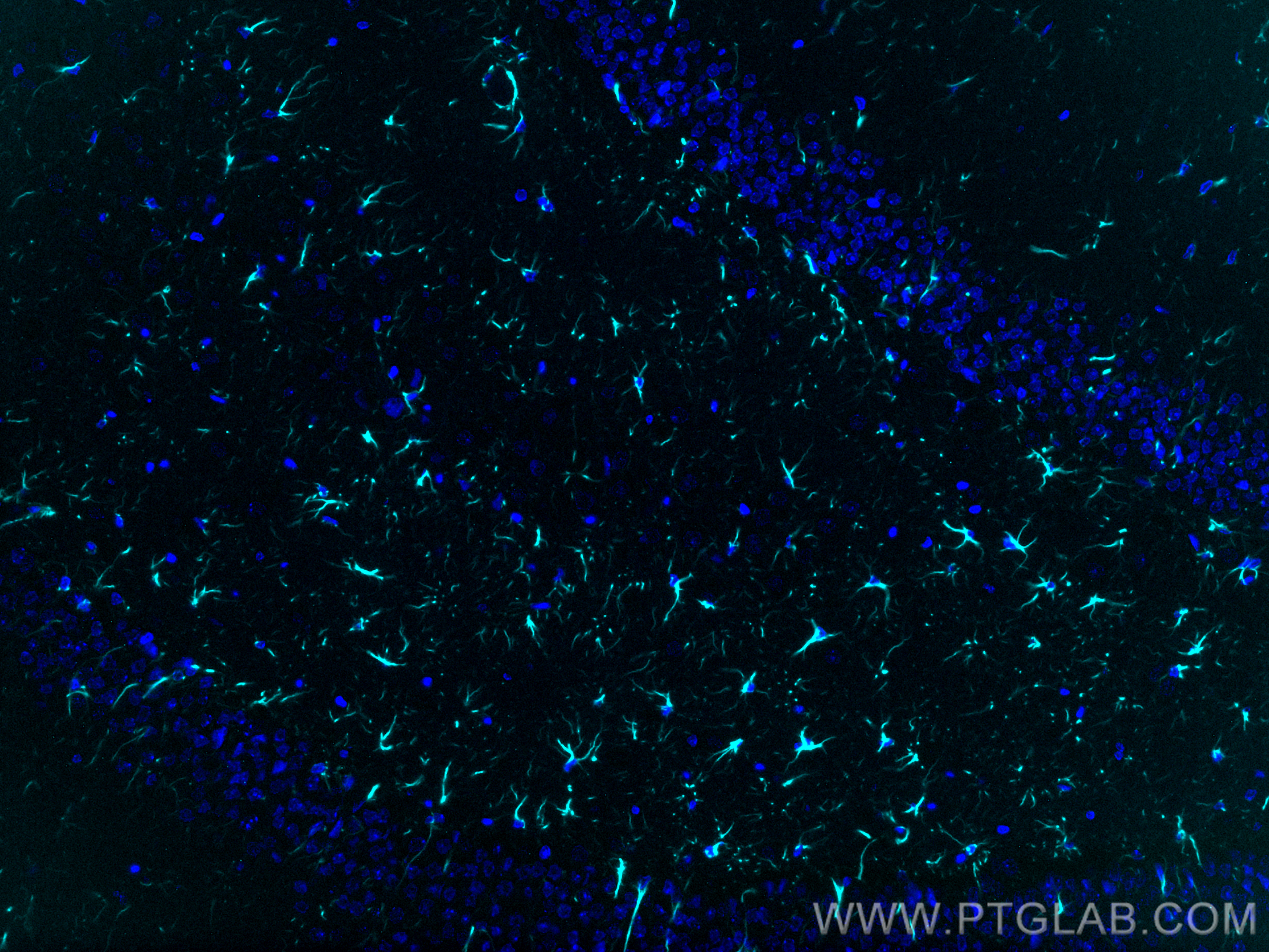 GFAP antibody (CL750-16825) | Proteintech