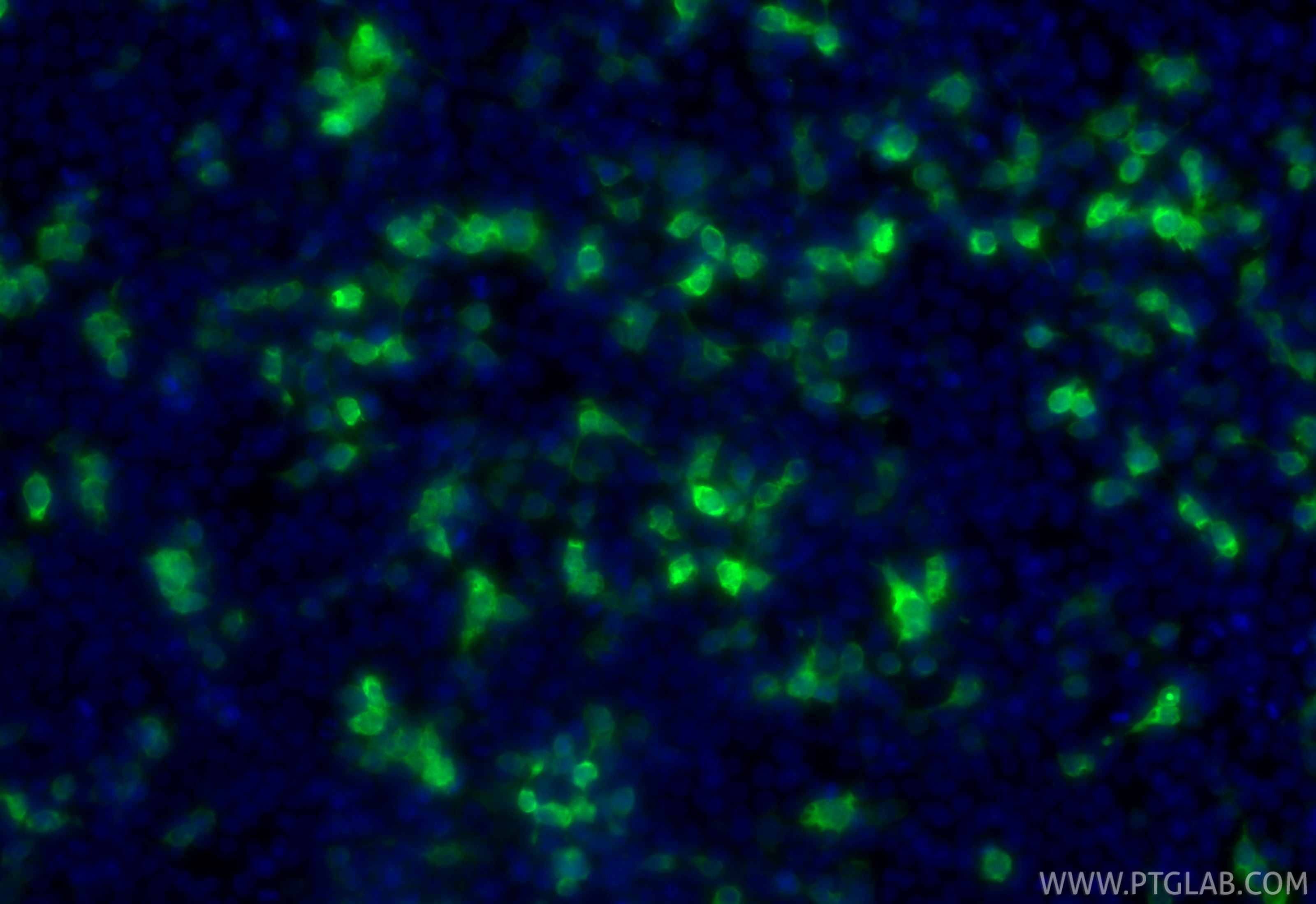Immunofluorescence (IF) / fluorescent staining of Transfected HEK-293 cells using CoraLite® Plus 488-conjugated GFP tag Polyclonal a (CL488-50430)