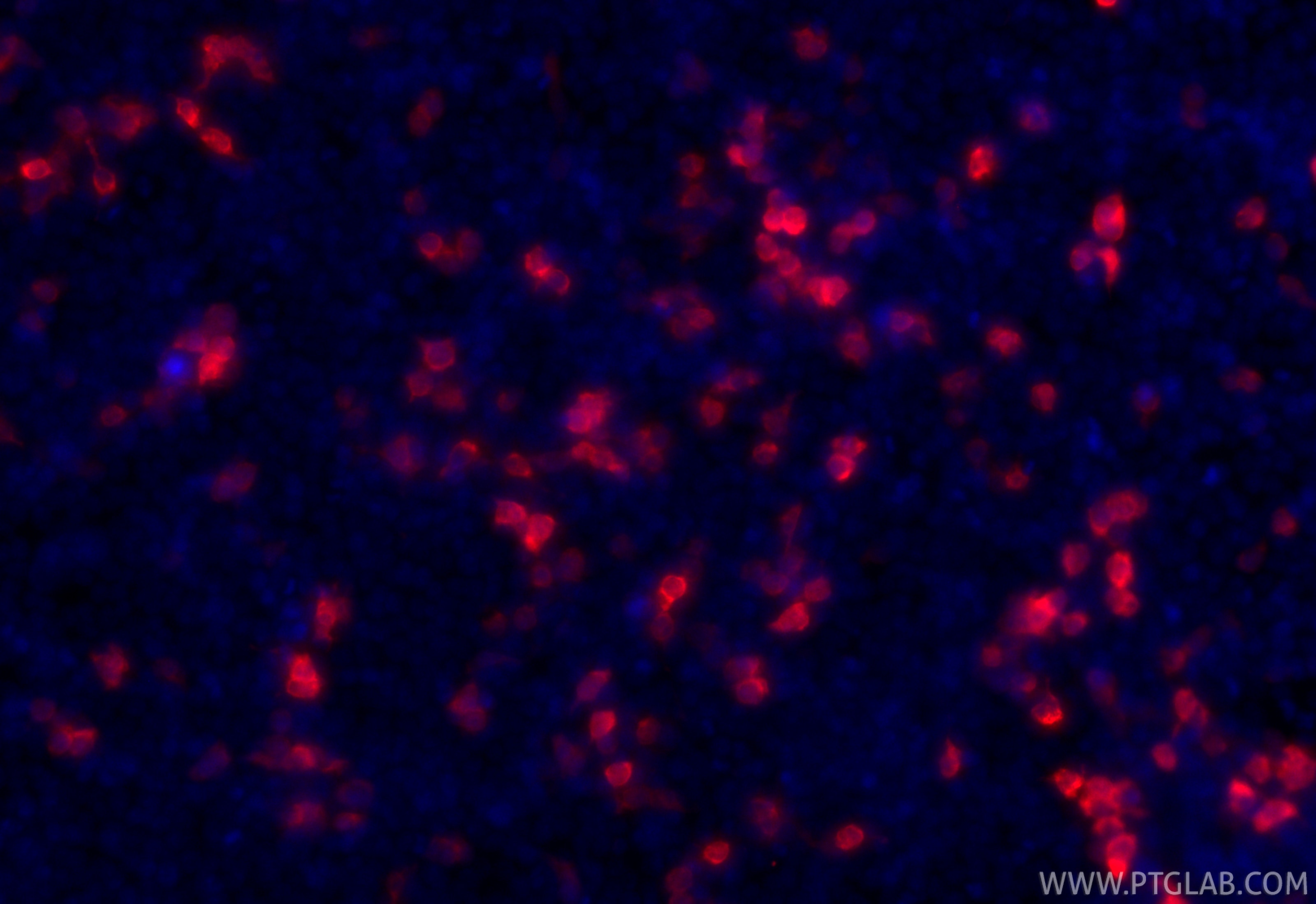 Immunofluorescence (IF) / fluorescent staining of Transfected HEK-293 cells using CoraLite®594-conjugated GFP tag Polyclonal antibod (CL594-50430)