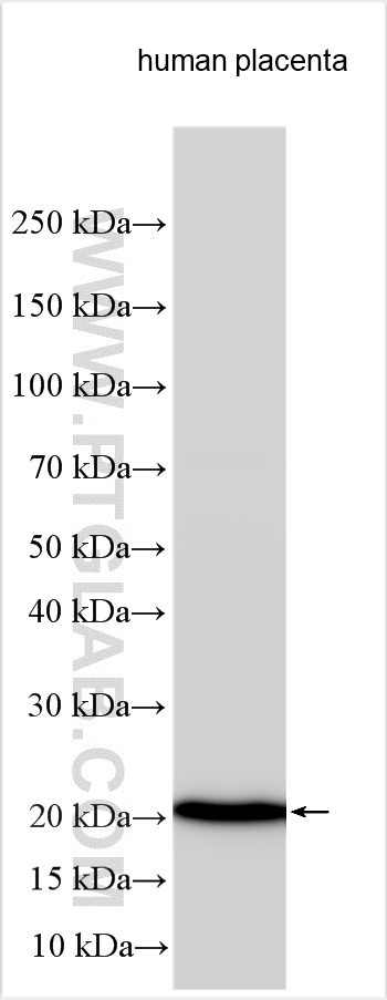 Western Blot (WB) analysis of various lysates using Growth Hormone Polyclonal antibody (30345-1-AP)