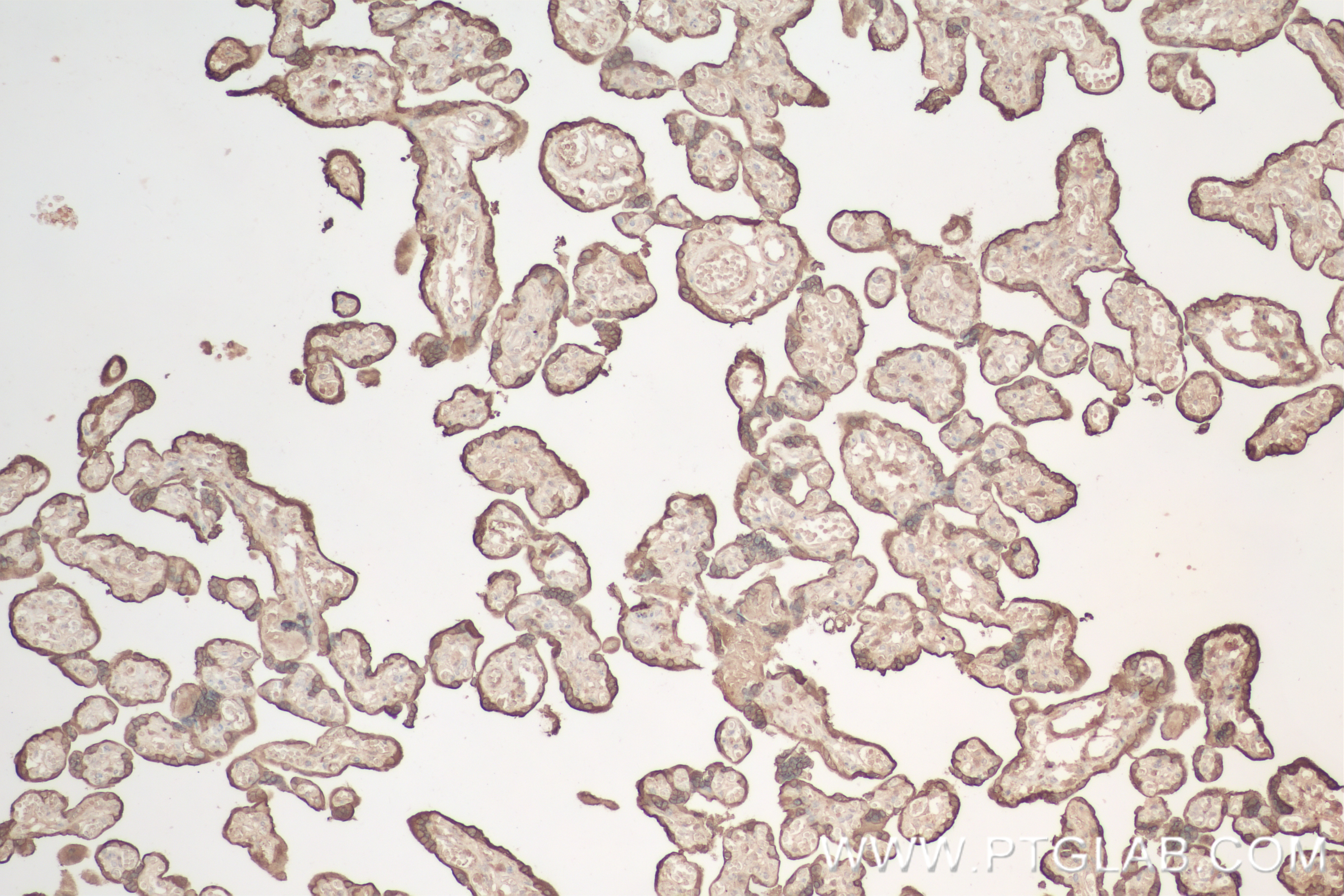 Immunohistochemistry (IHC) staining of human placenta tissue using Growth Hormone Recombinant antibody (82813-2-RR)