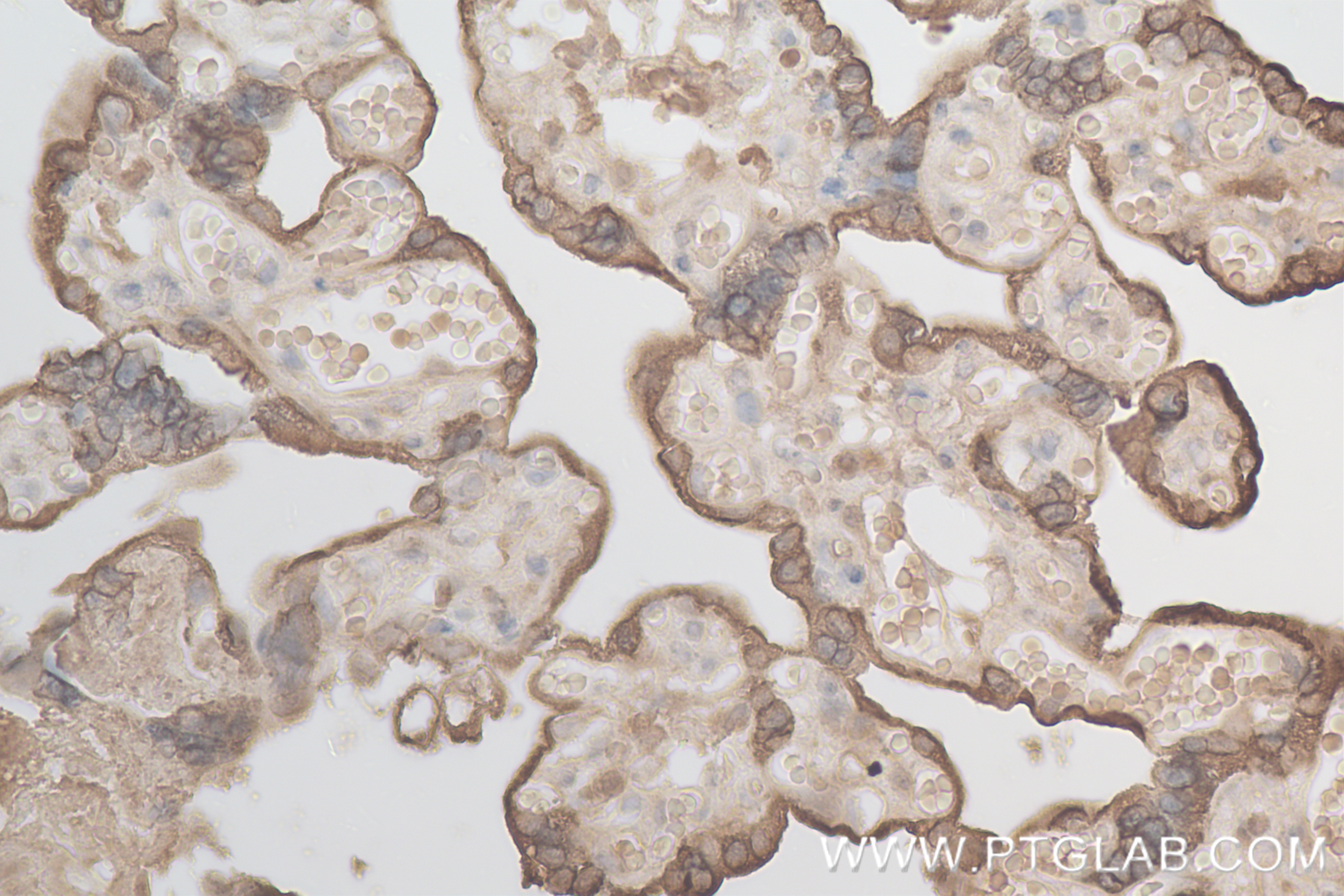 Immunohistochemistry (IHC) staining of human placenta tissue using Growth Hormone Recombinant antibody (82813-2-RR)