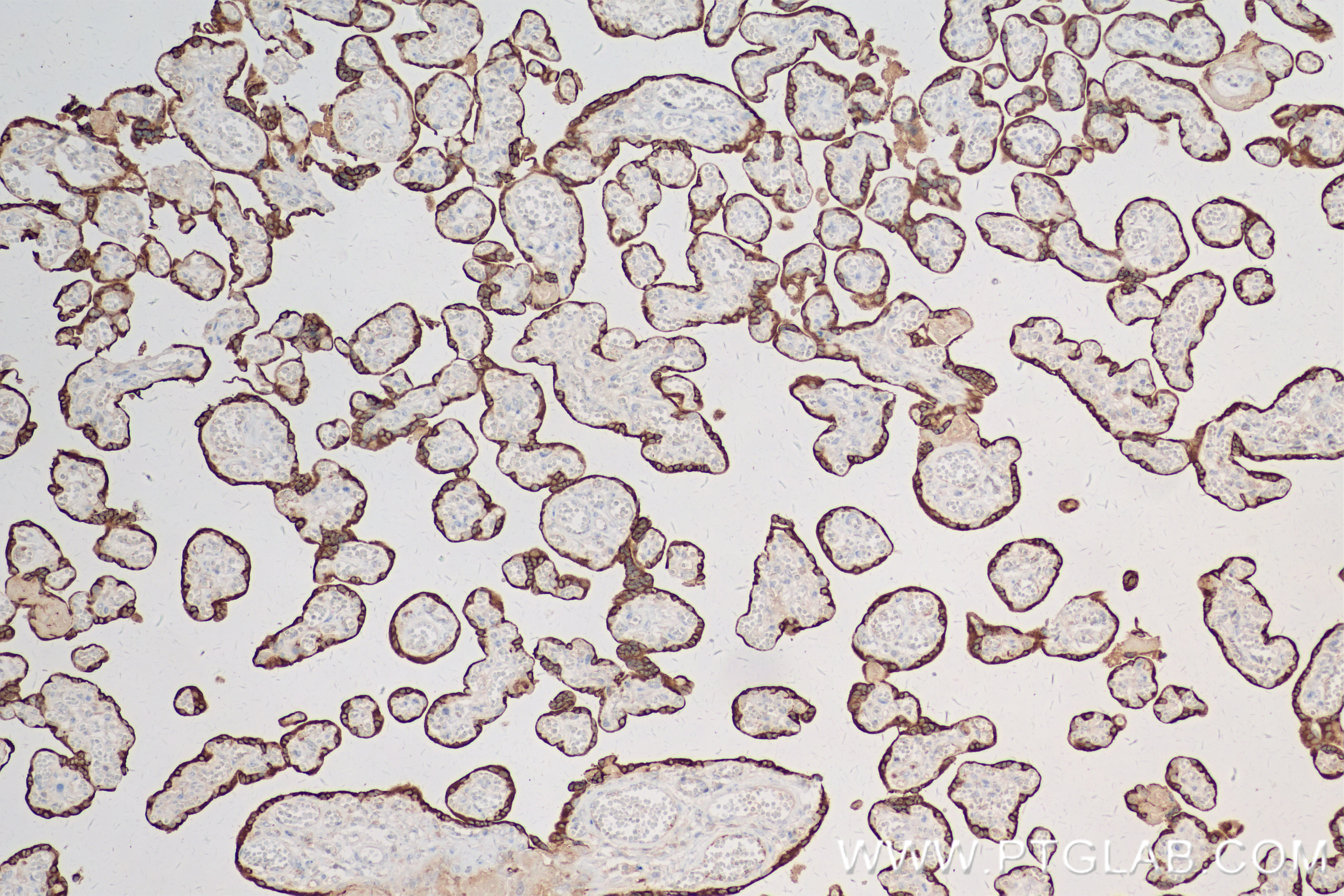 Immunohistochemistry (IHC) staining of human placenta tissue using Growth Hormone Recombinant antibody (82813-2-RR)