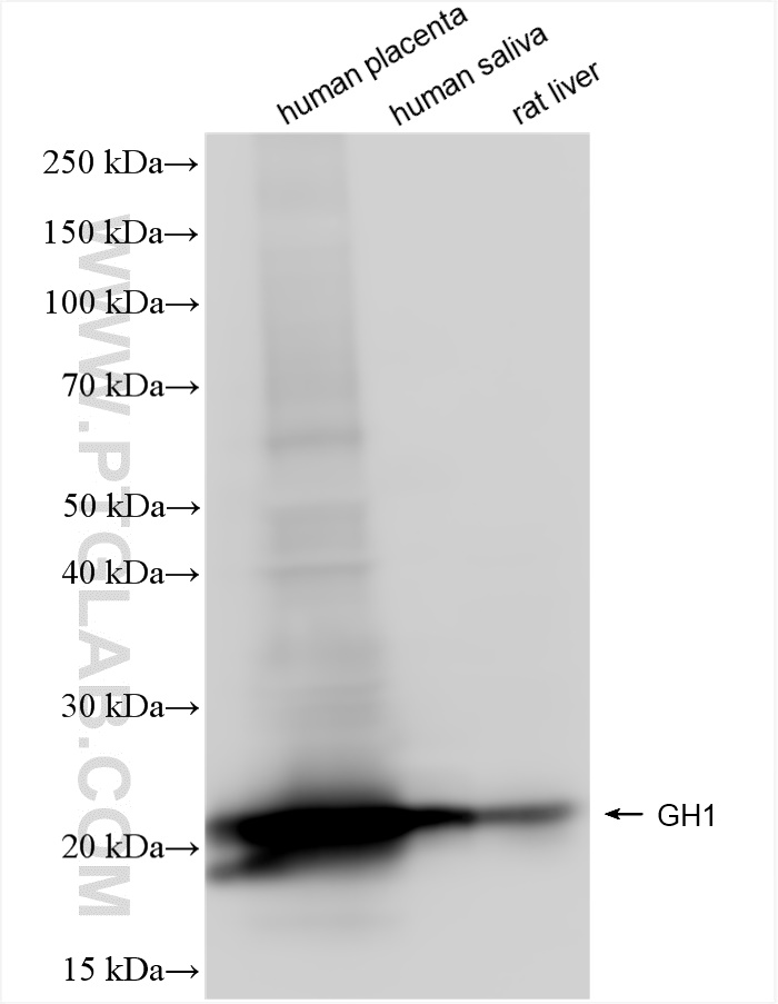 Western Blot (WB) analysis of various lysates using Growth Hormone Recombinant antibody (82813-2-RR)