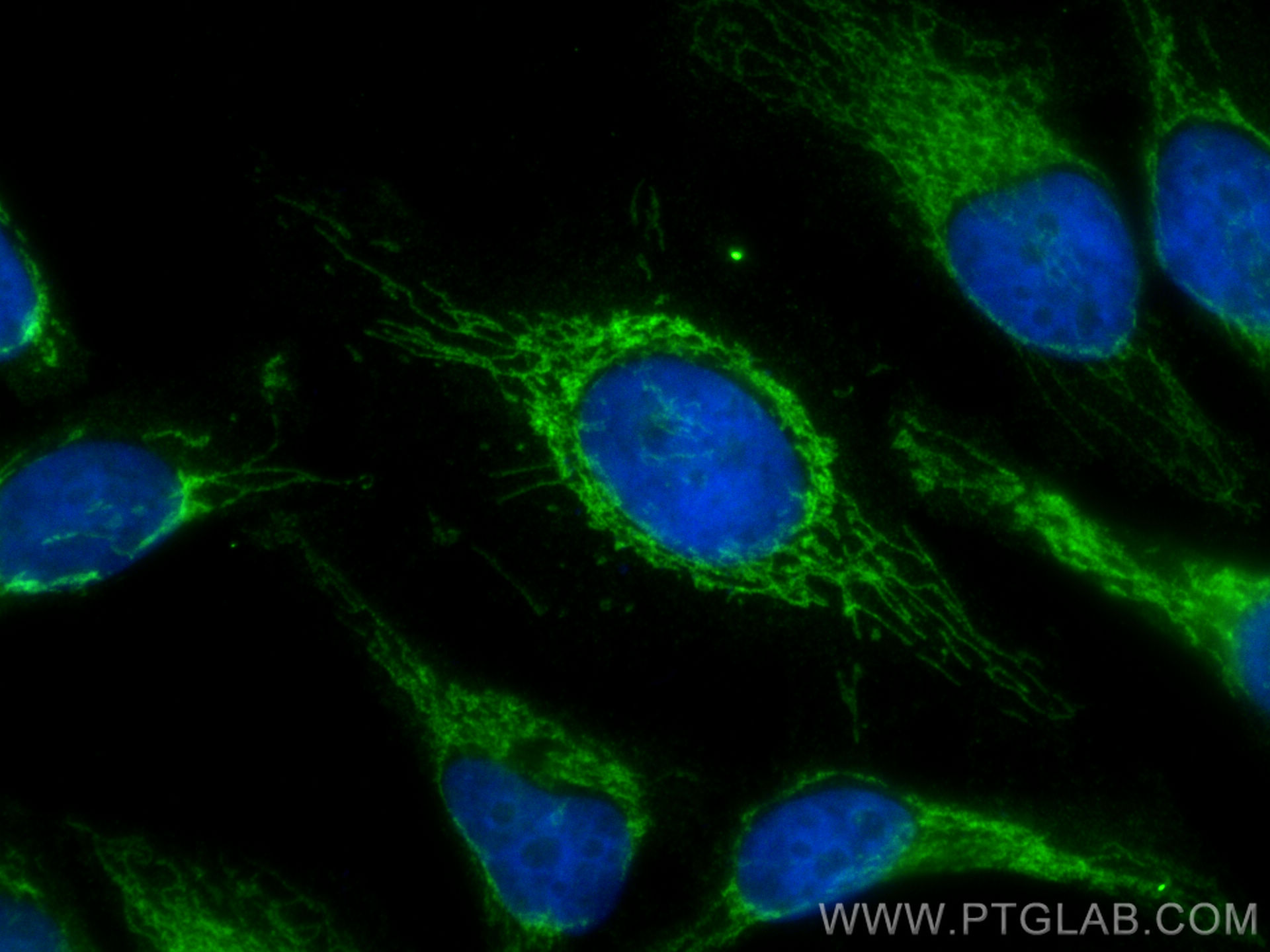 Immunofluorescence (IF) / fluorescent staining of HeLa cells using GHITM Polyclonal antibody (16296-1-AP)