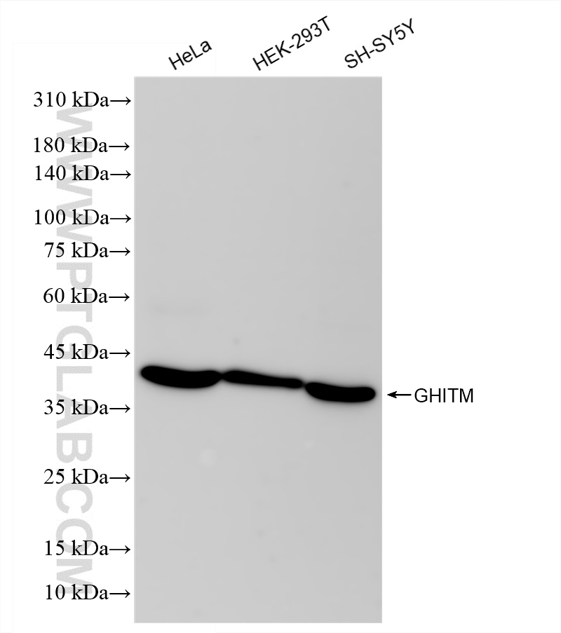 Western Blot (WB) analysis of various lysates using GHITM Recombinant antibody (83548-3-RR)