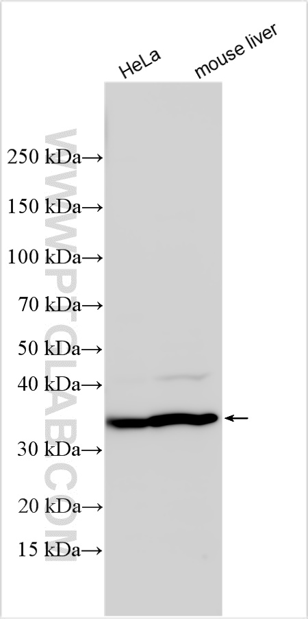 Western Blot (WB) analysis of various lysates using GHITM Recombinant antibody (83548-3-RR)