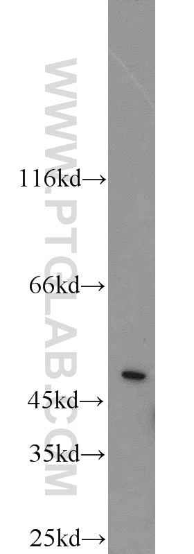 Western Blot (WB) analysis of HEK-293 cells using GHRHR Polyclonal antibody (20715-1-AP)