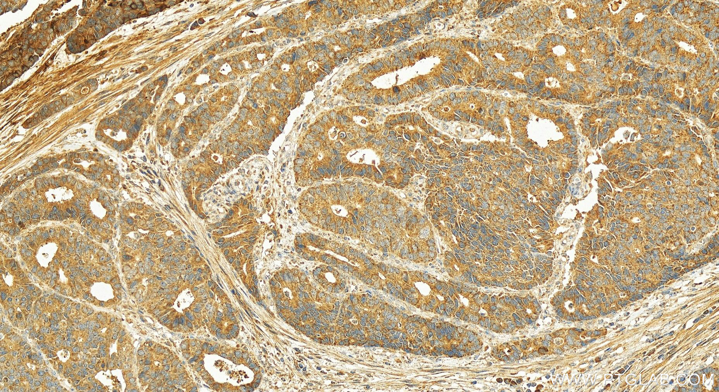 Immunohistochemistry (IHC) staining of human stomach tissue using GHRL Polyclonal antibody (13309-1-AP)