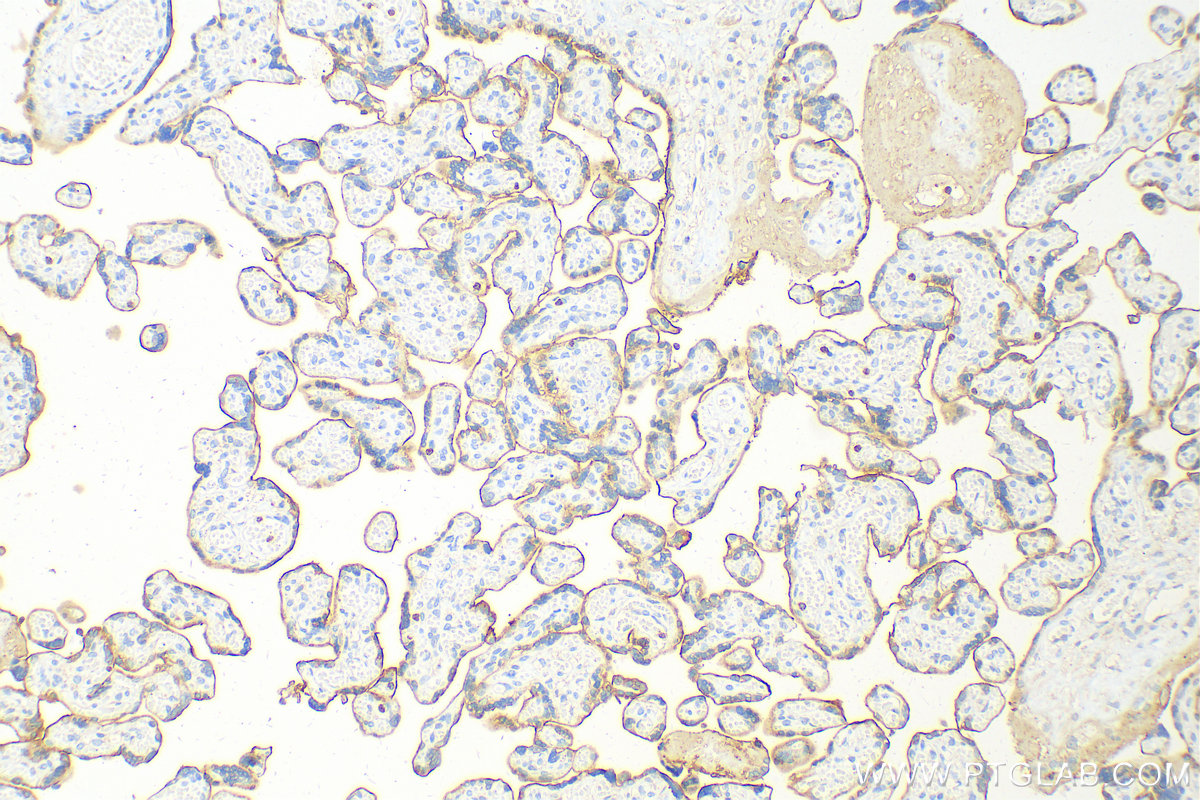 Immunohistochemistry (IHC) staining of human placenta tissue using VISTA Polyclonal antibody (24849-1-AP)