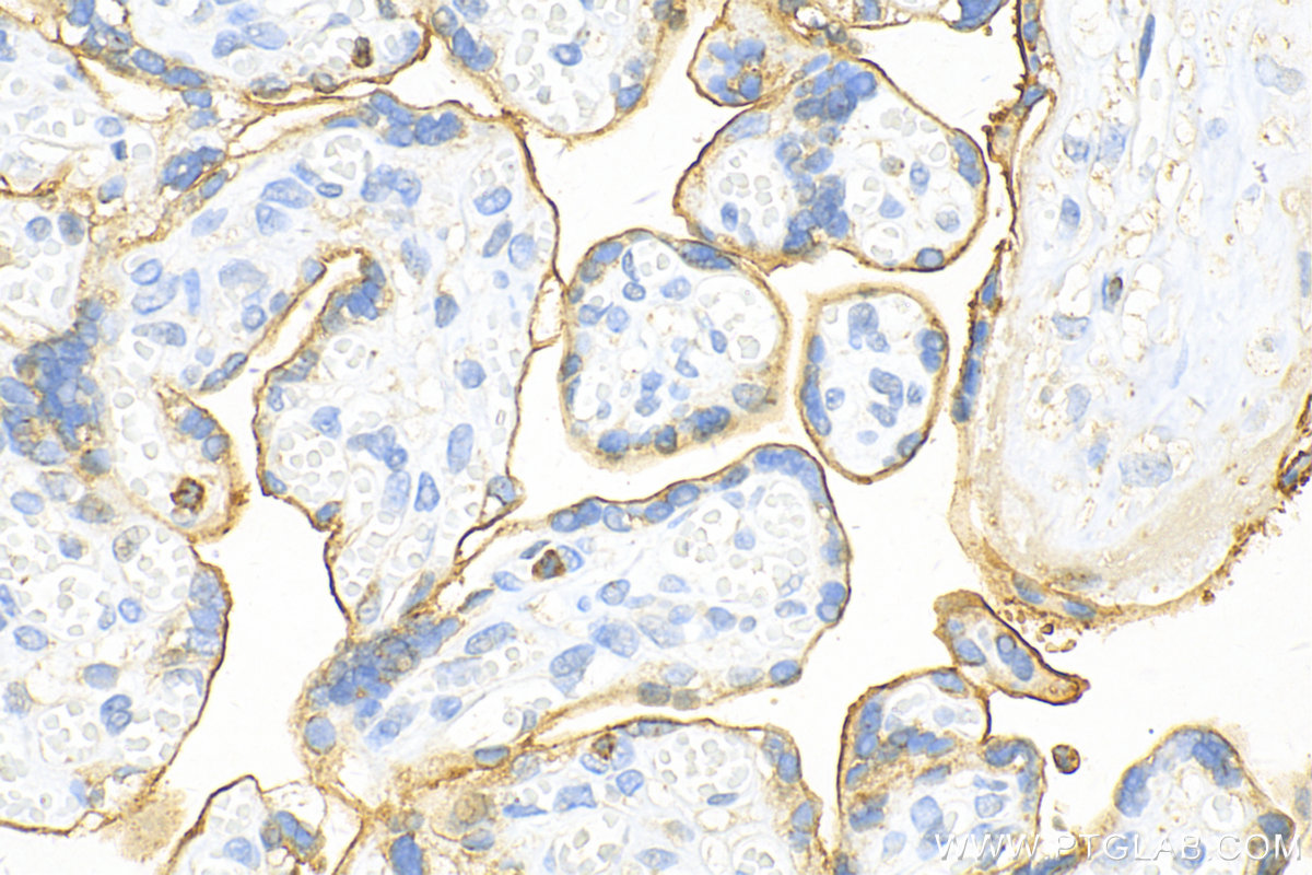 Immunohistochemistry (IHC) staining of human placenta tissue using VISTA Polyclonal antibody (24849-1-AP)