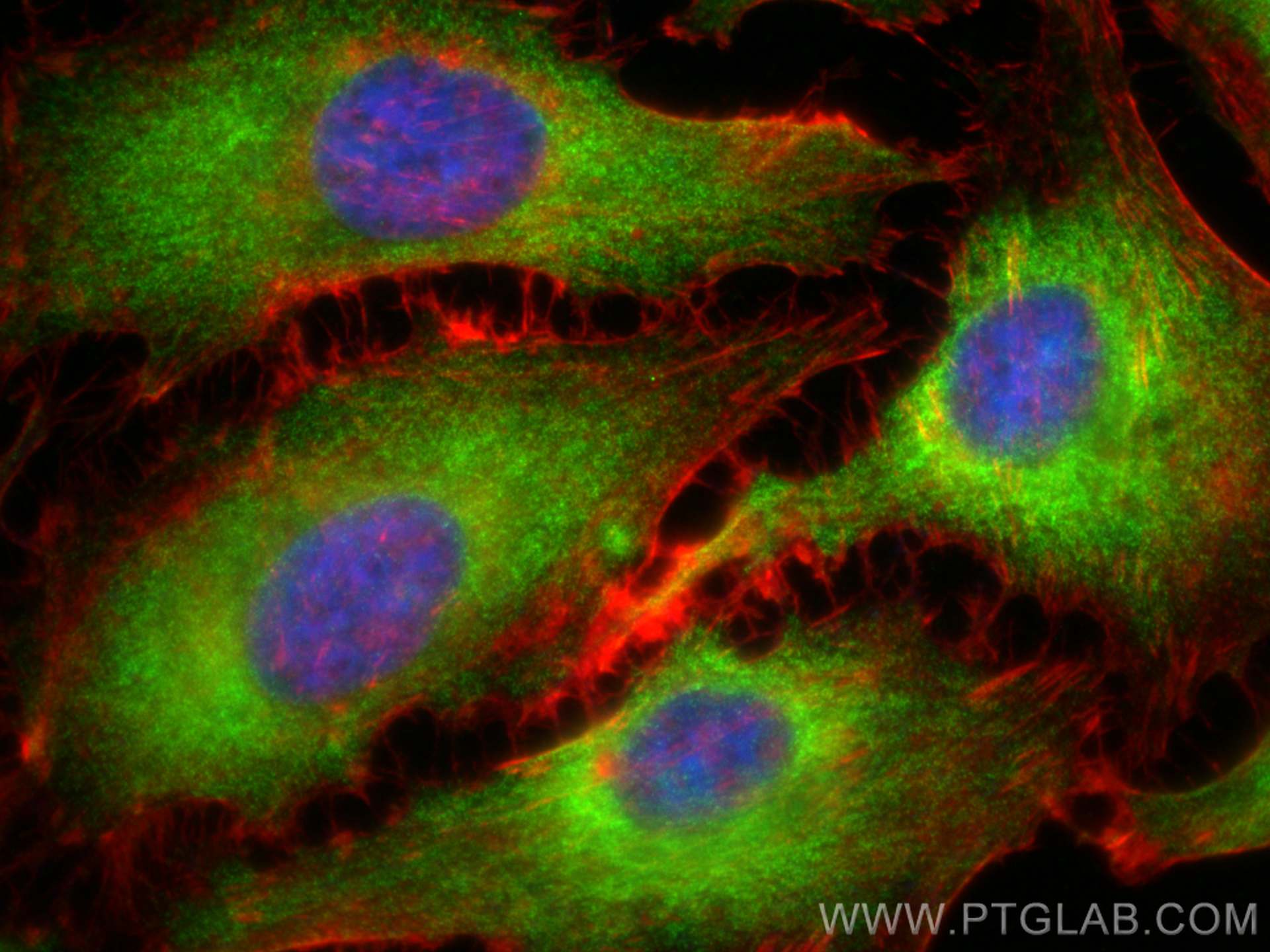 Immunofluorescence (IF) / fluorescent staining of HeLa cells using GIGYF2 Polyclonal antibody (24790-1-AP)