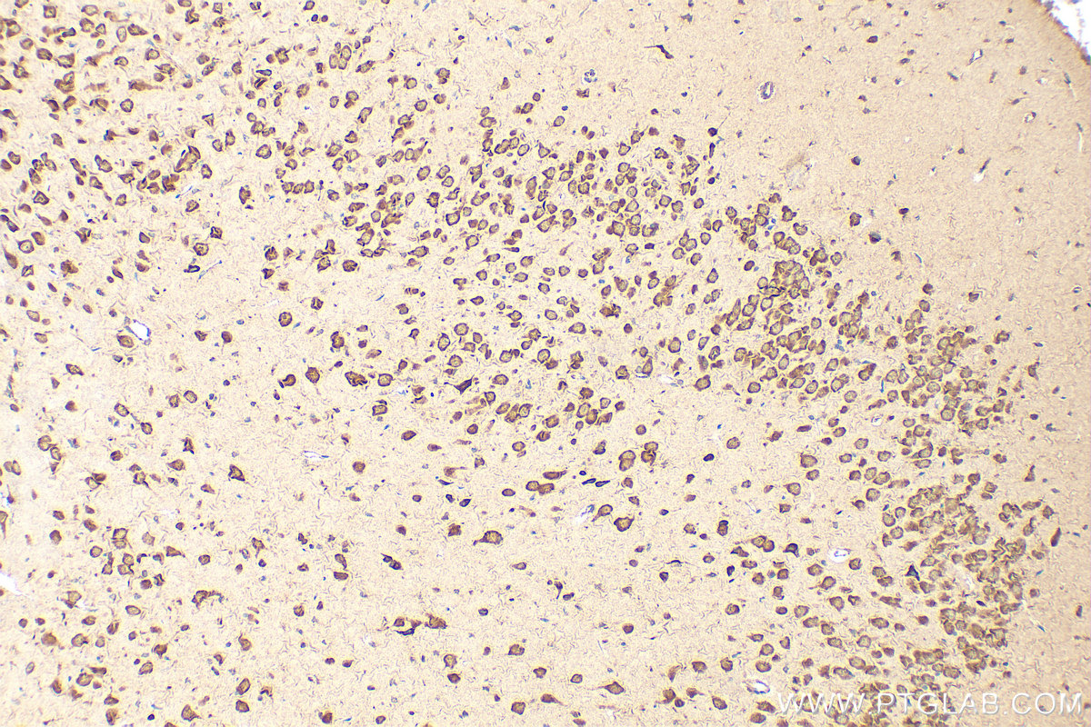 Immunohistochemistry (IHC) staining of rat brain tissue using GIGYF2 Polyclonal antibody (24790-1-AP)