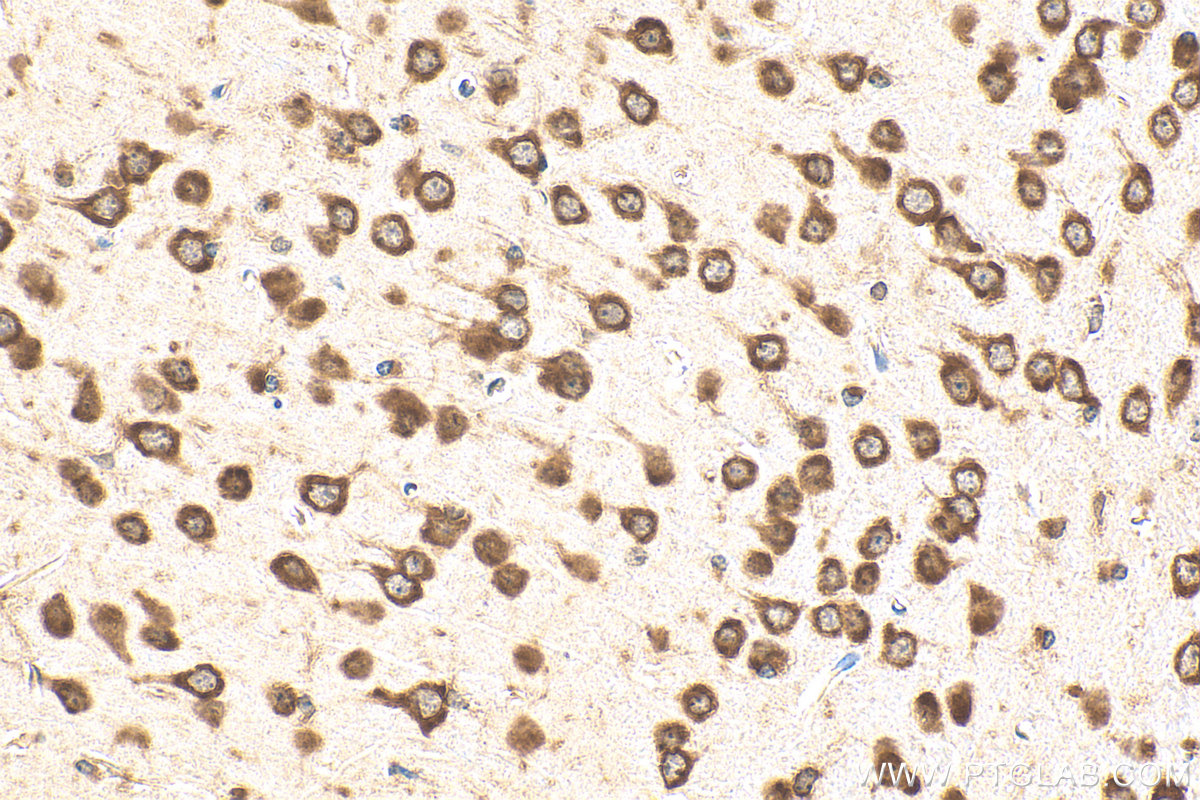 Immunohistochemistry (IHC) staining of mouse brain tissue using GIGYF2 Polyclonal antibody (24790-1-AP)