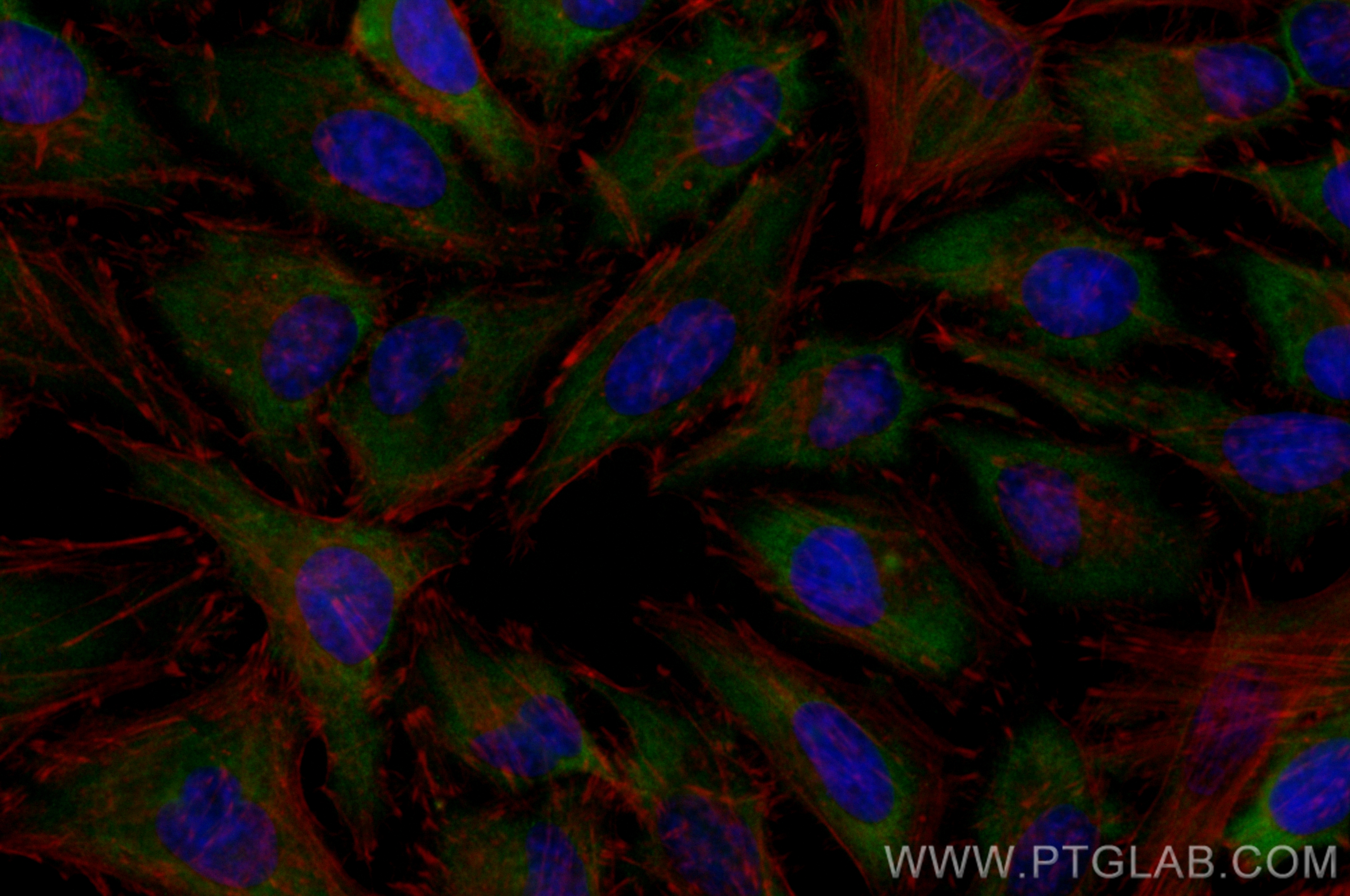 Immunofluorescence (IF) / fluorescent staining of HeLa cells using CoraLite® Plus 488-conjugated GIGYF2 Polyclonal an (CL488-24790)