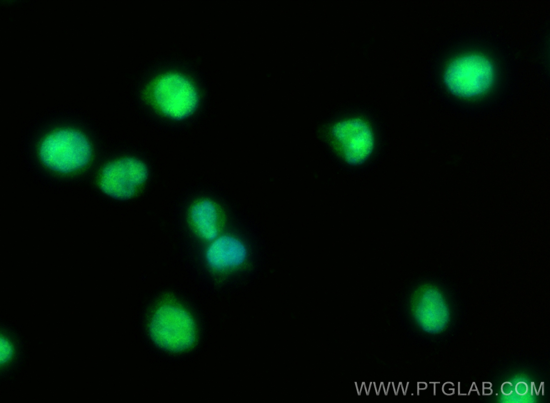 Immunofluorescence (IF) / fluorescent staining of Jurkat cells using GINS2 Polyclonal antibody (16247-1-AP)