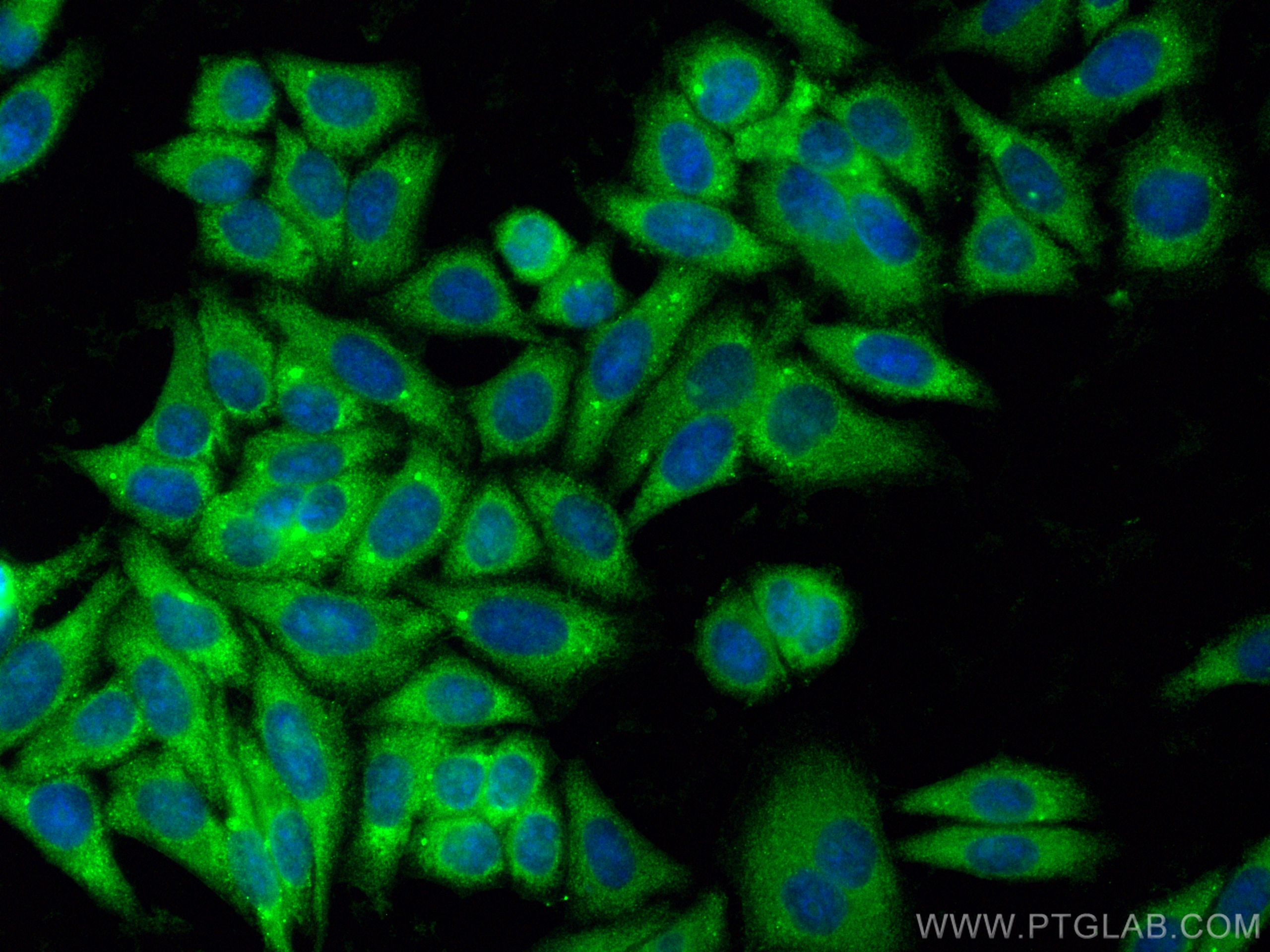 Immunofluorescence (IF) / fluorescent staining of HepG2 cells using CoraLite® Plus 488-conjugated GIPC1 Polyclonal ant (CL488-14822)