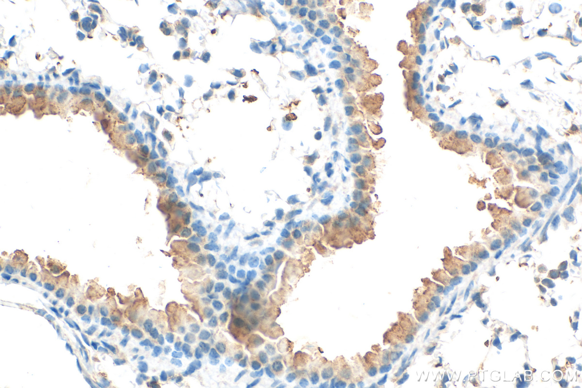 Immunohistochemistry (IHC) staining of mouse lung tissue using Connexin 40 Polyclonal antibody (26602-1-AP)