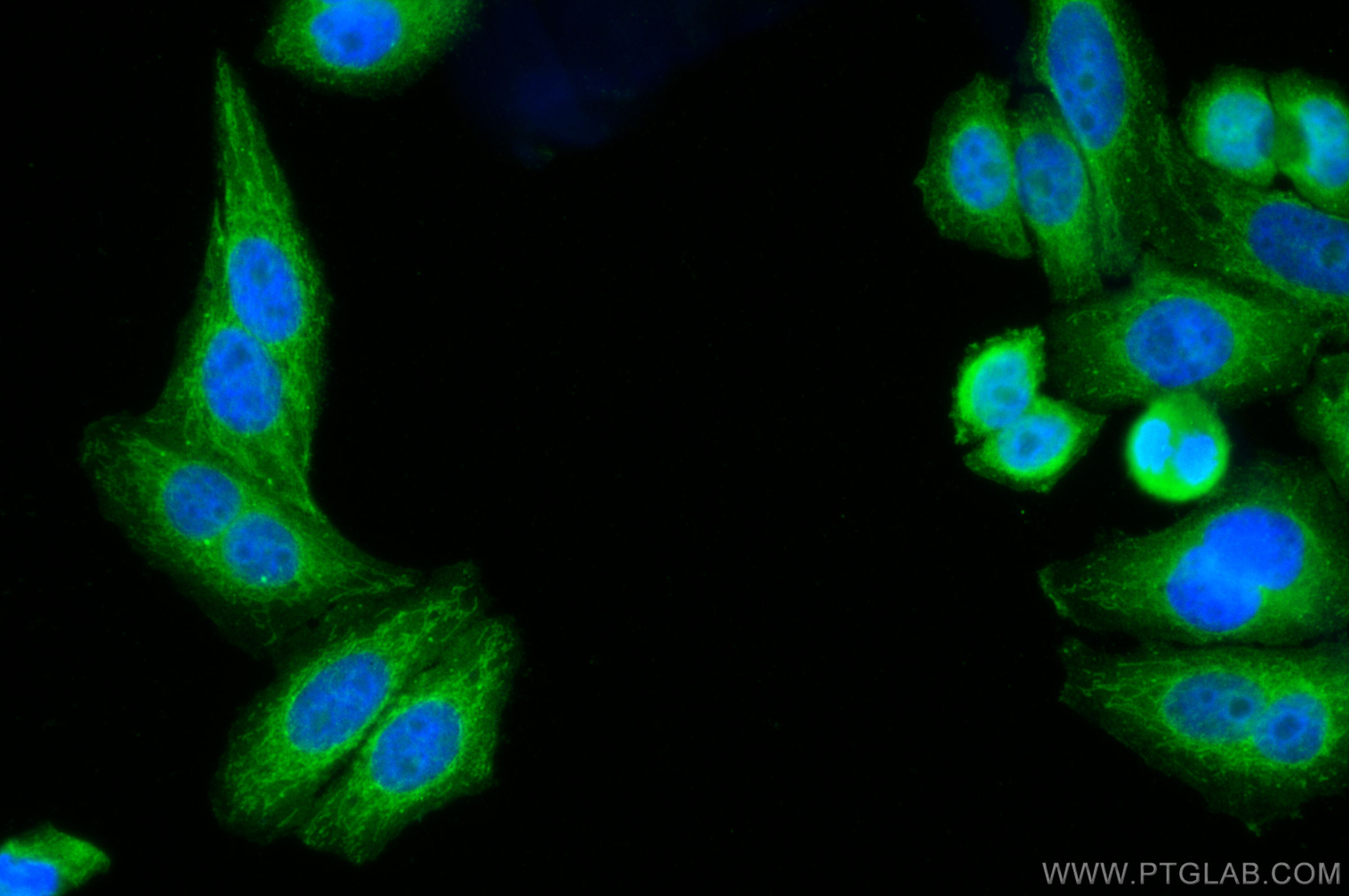 Immunofluorescence (IF) / fluorescent staining of HepG2 cells using Glycerokinase Polyclonal antibody (13360-1-AP)