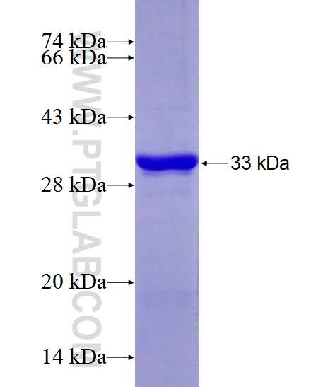 GK5 fusion protein Ag28536 SDS-PAGE