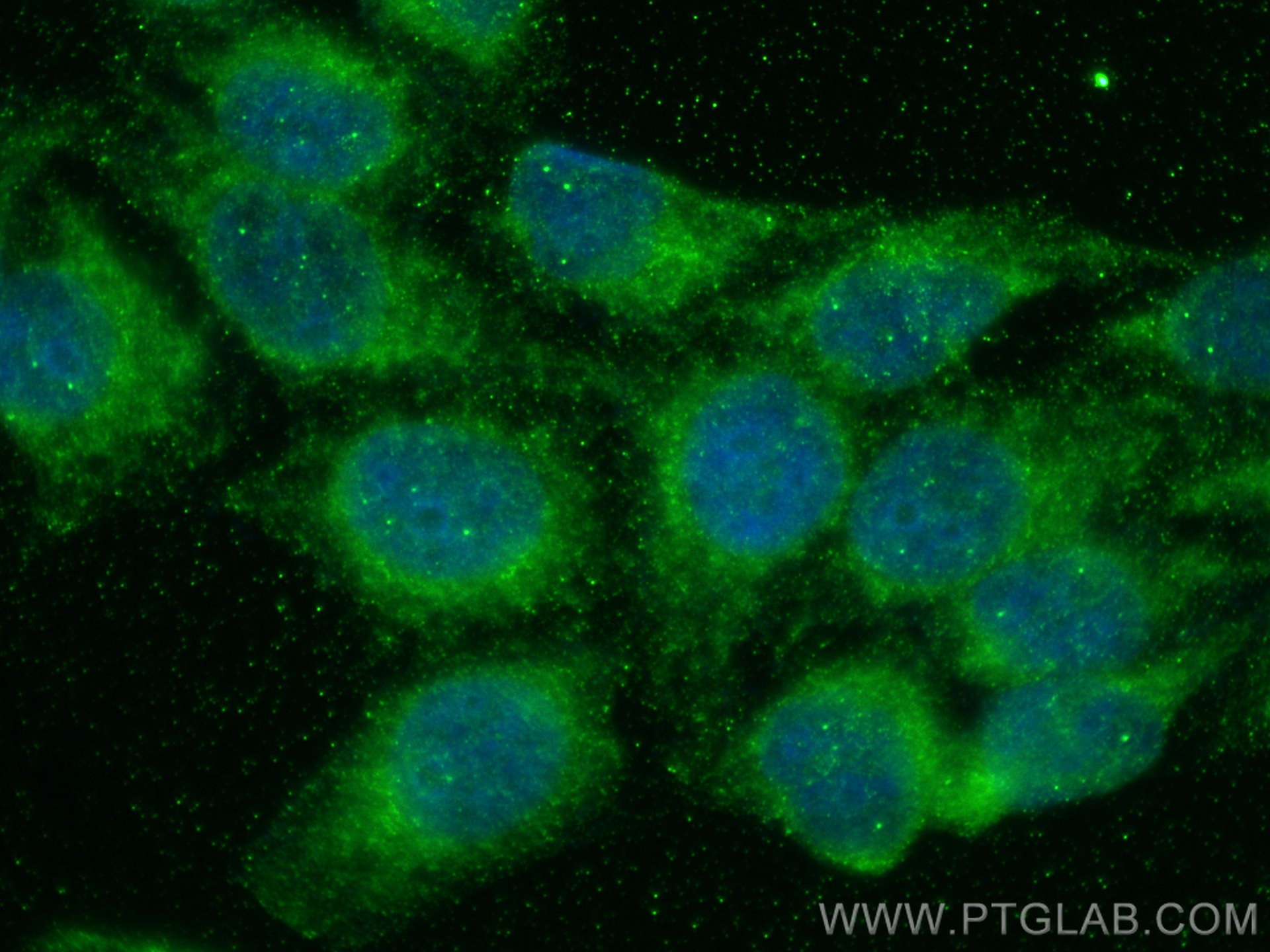 Immunofluorescence (IF) / fluorescent staining of HepG2 cells using Alpha Galactosidase A Monoclonal antibody (66121-1-Ig)