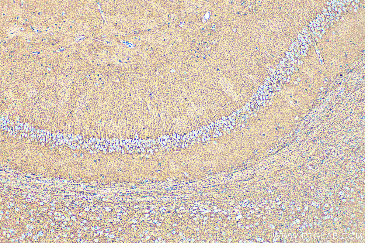 Immunohistochemistry (IHC) staining of mouse brain tissue using GLAST/EAAT1 Polyclonal antibody (20785-1-AP)