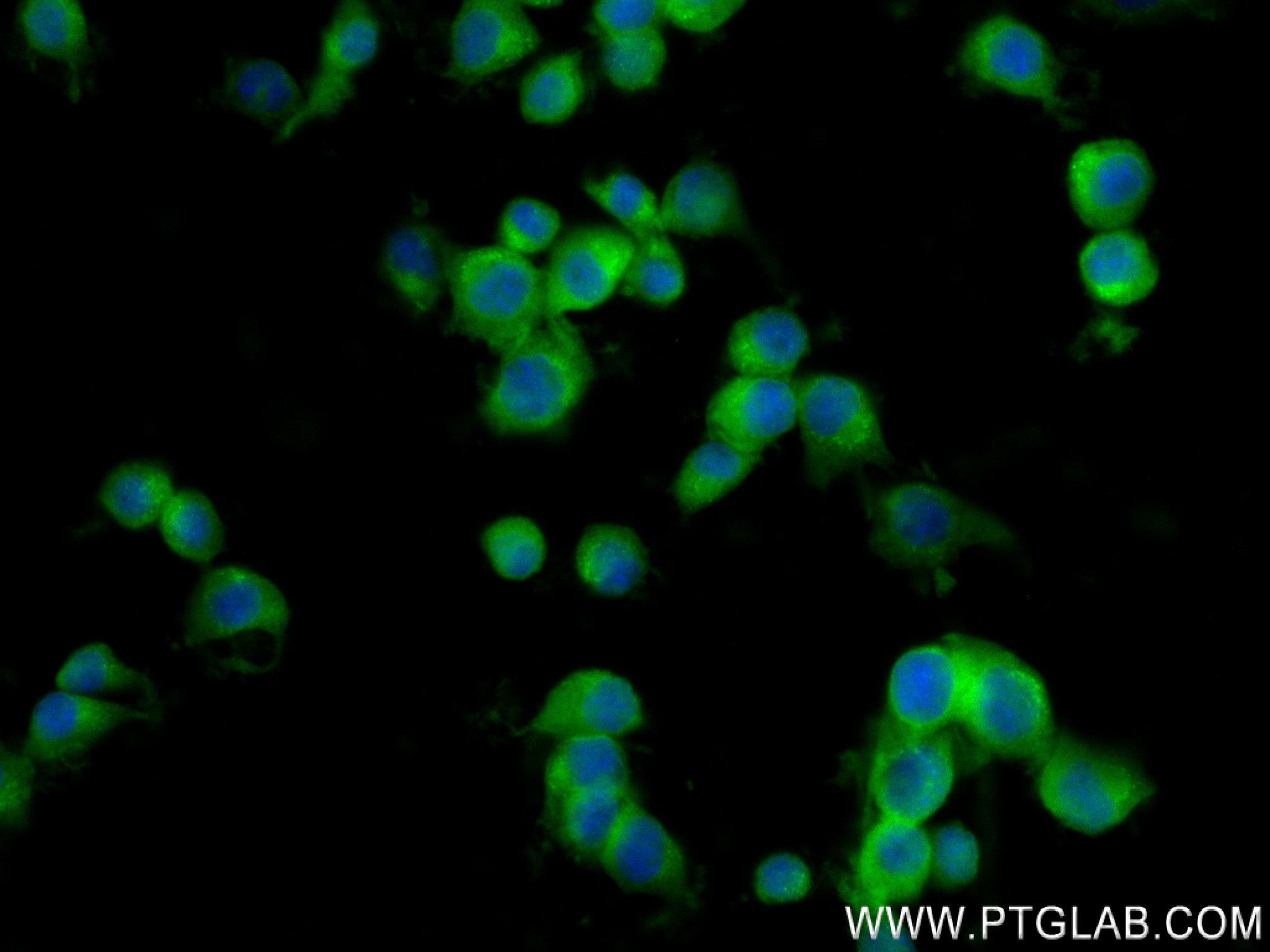 Immunofluorescence (IF) / fluorescent staining of Neuro-2a cells using GLAST/EAAT1 Recombinant monoclonal antibody (84497-4-RR)