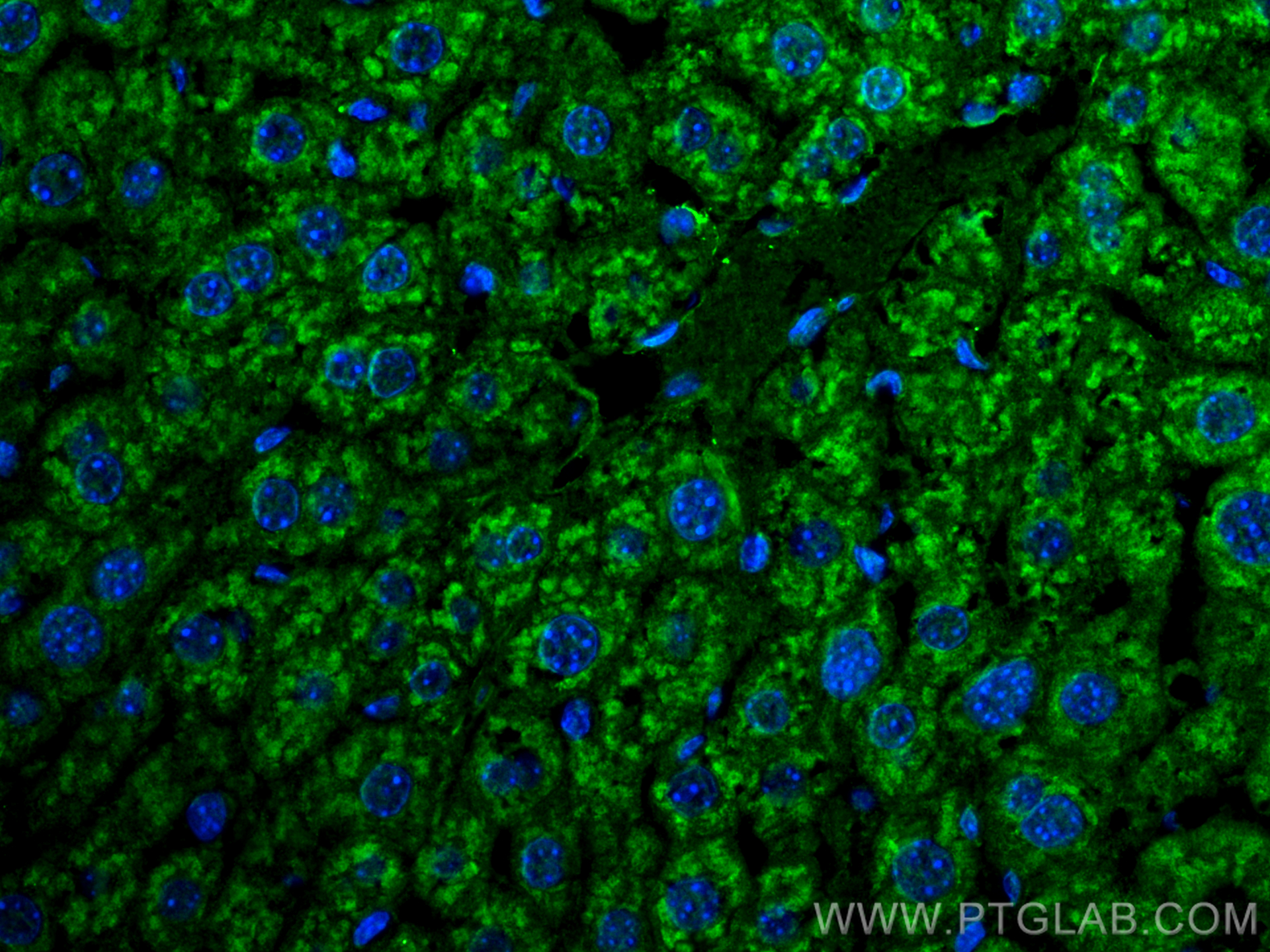 Immunofluorescence (IF) / fluorescent staining of mouse liver tissue using Beta Galactosidase Polyclonal antibody (15518-1-AP)