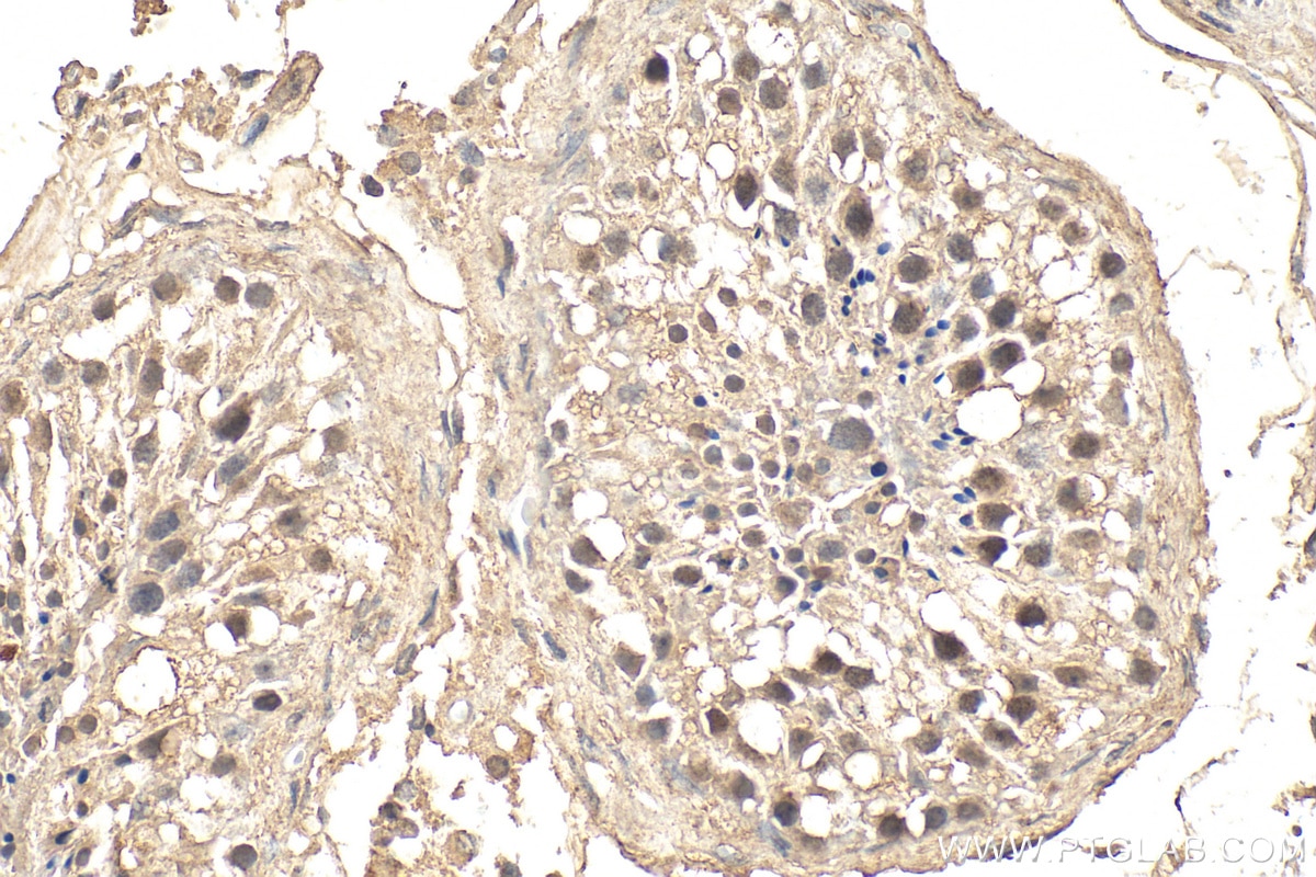 Immunohistochemistry (IHC) staining of human testis tissue using GLI1 Monoclonal antibody (66905-1-Ig)