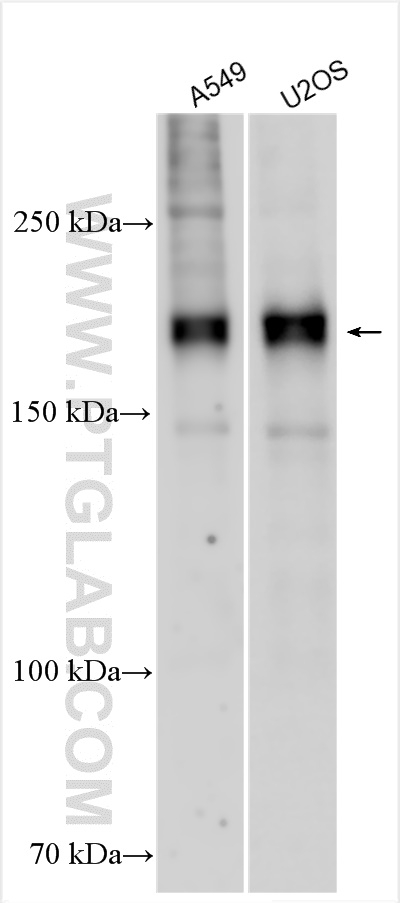 Western Blot (WB) analysis of various lysates using GLI2 Polyclonal antibody (28245-1-AP)