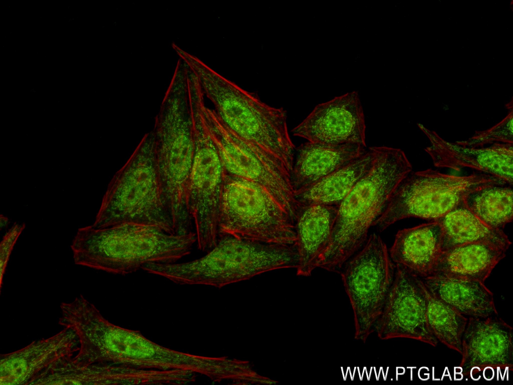 Immunofluorescence (IF) / fluorescent staining of HepG2 cells using GLI2-Specific Recombinant antibody (84141-1-RR)