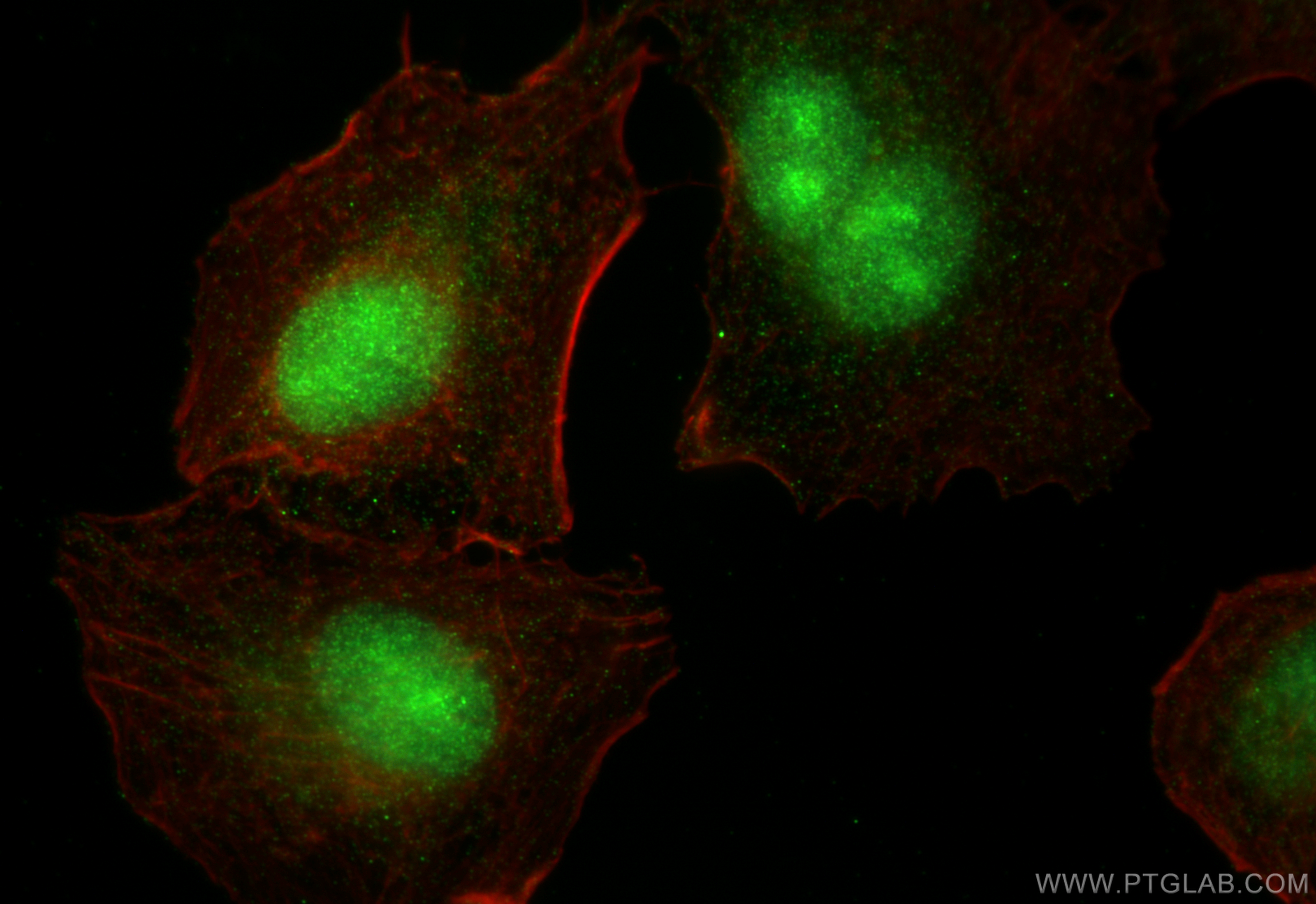 Immunofluorescence (IF) / fluorescent staining of A549 cells using GLI4 Polyclonal antibody (16551-1-AP)