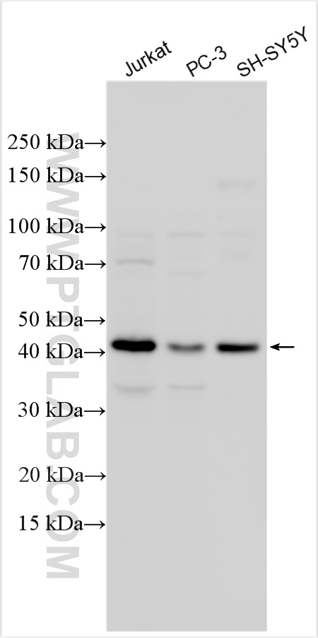 Western Blot (WB) analysis of various lysates using GLI4 Polyclonal antibody (16551-1-AP)